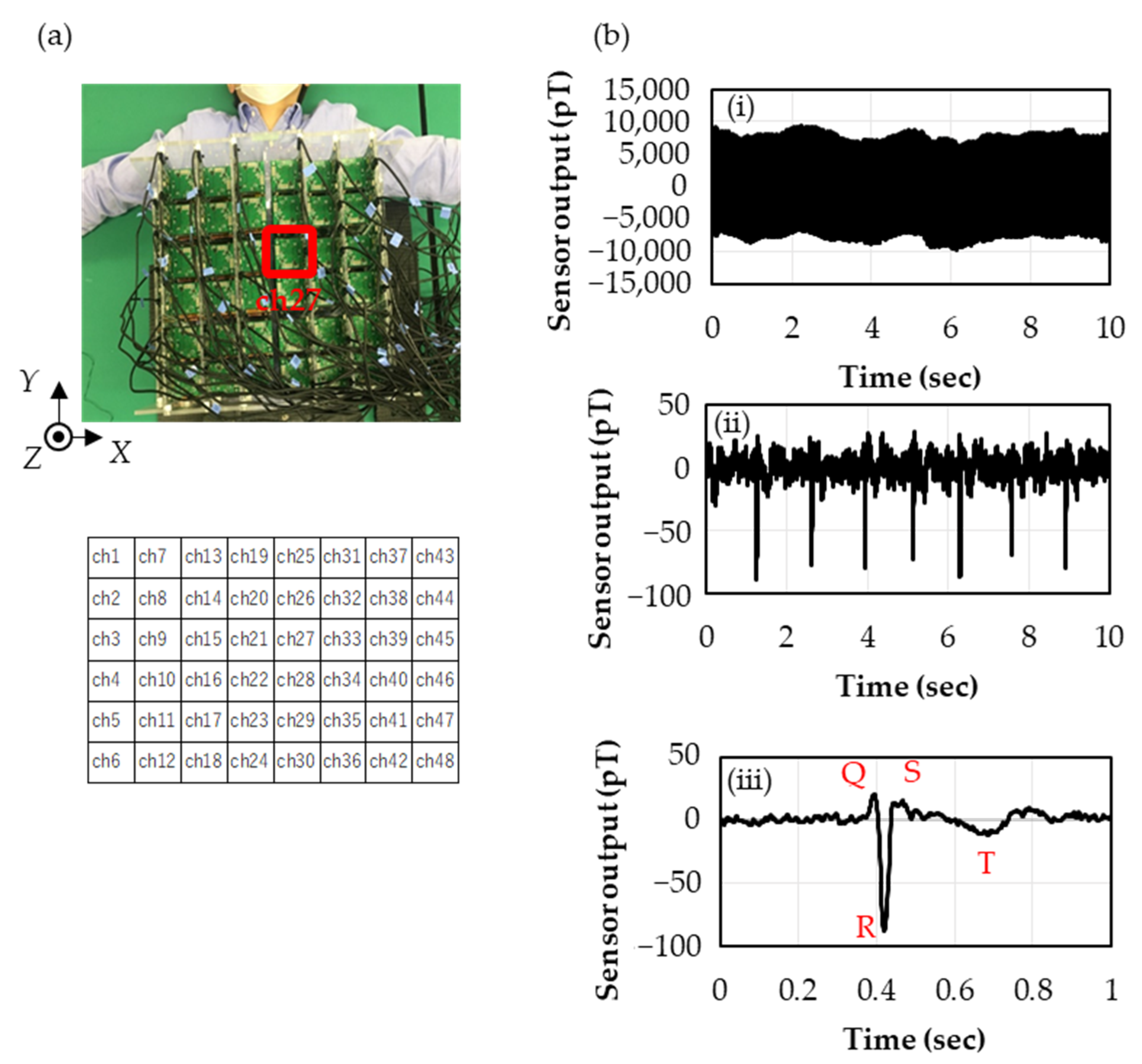 Sensors 23 00646 g004 Sensors 23 00646 g004
