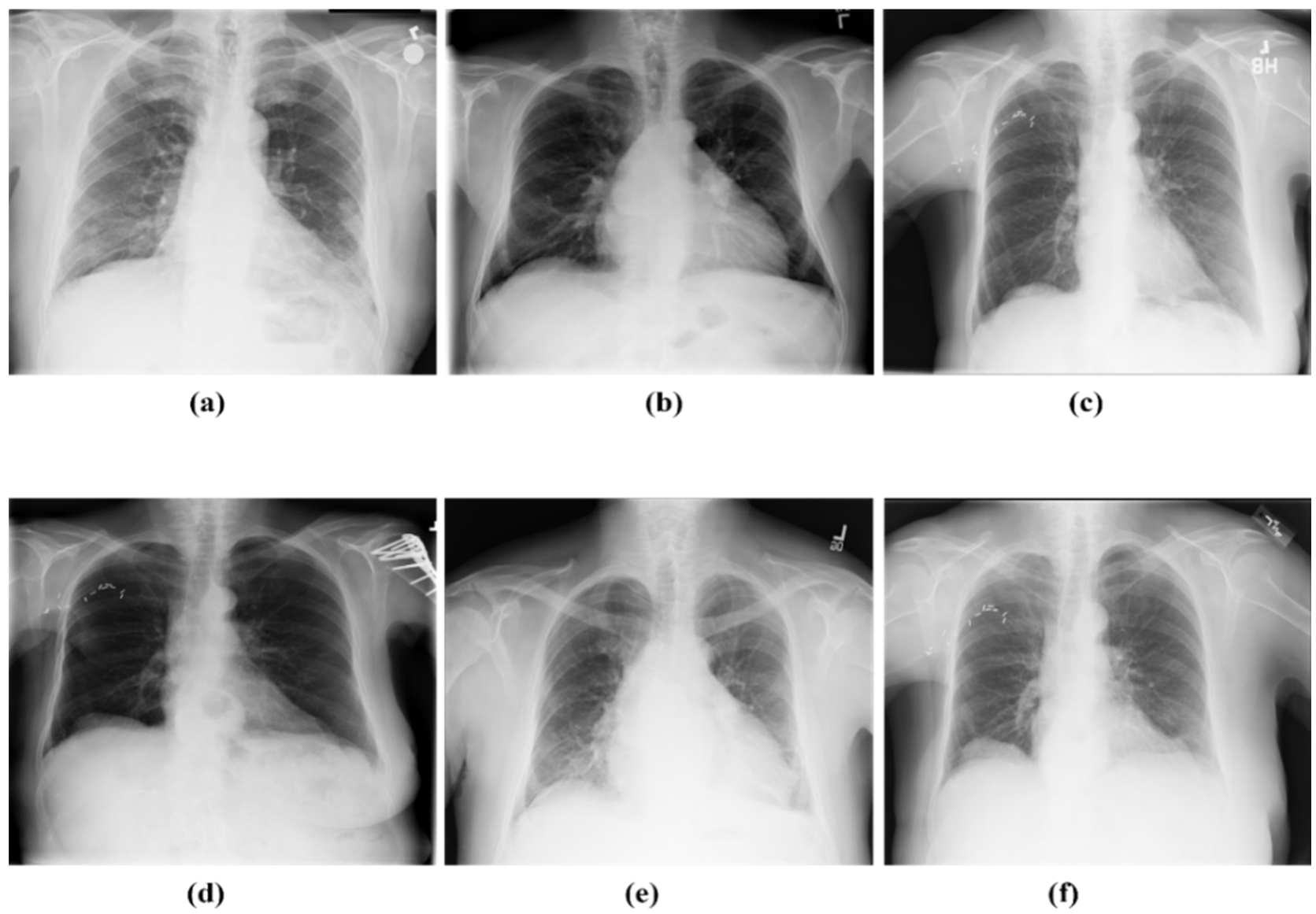 Sensors | Free Full-Text | DMFL_Net: A Federated Learning-Based Framework  for the Classification of COVID-19 from Multiple Chest Diseases Using X-rays