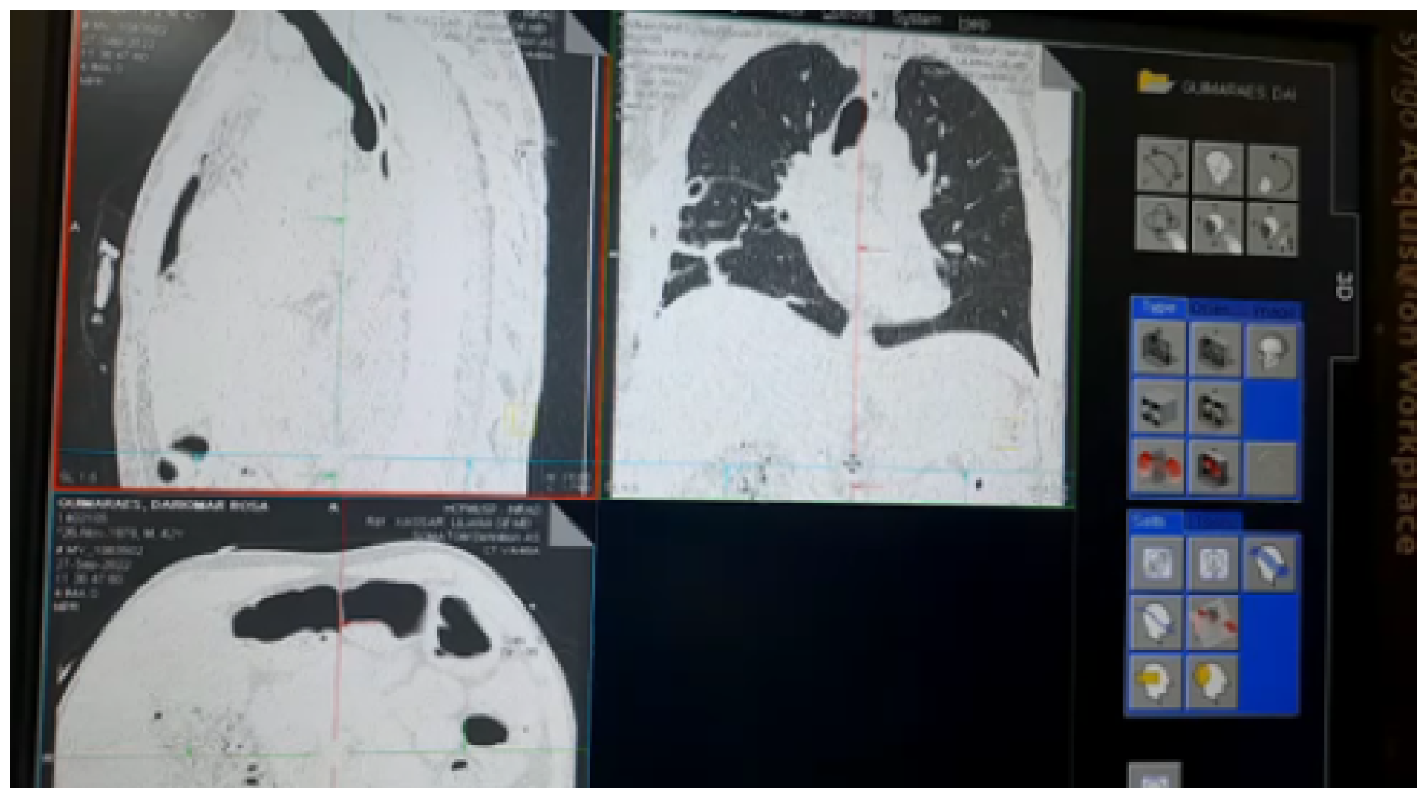 Sensors 23 01047 g018 Sensors 23 01047 g018