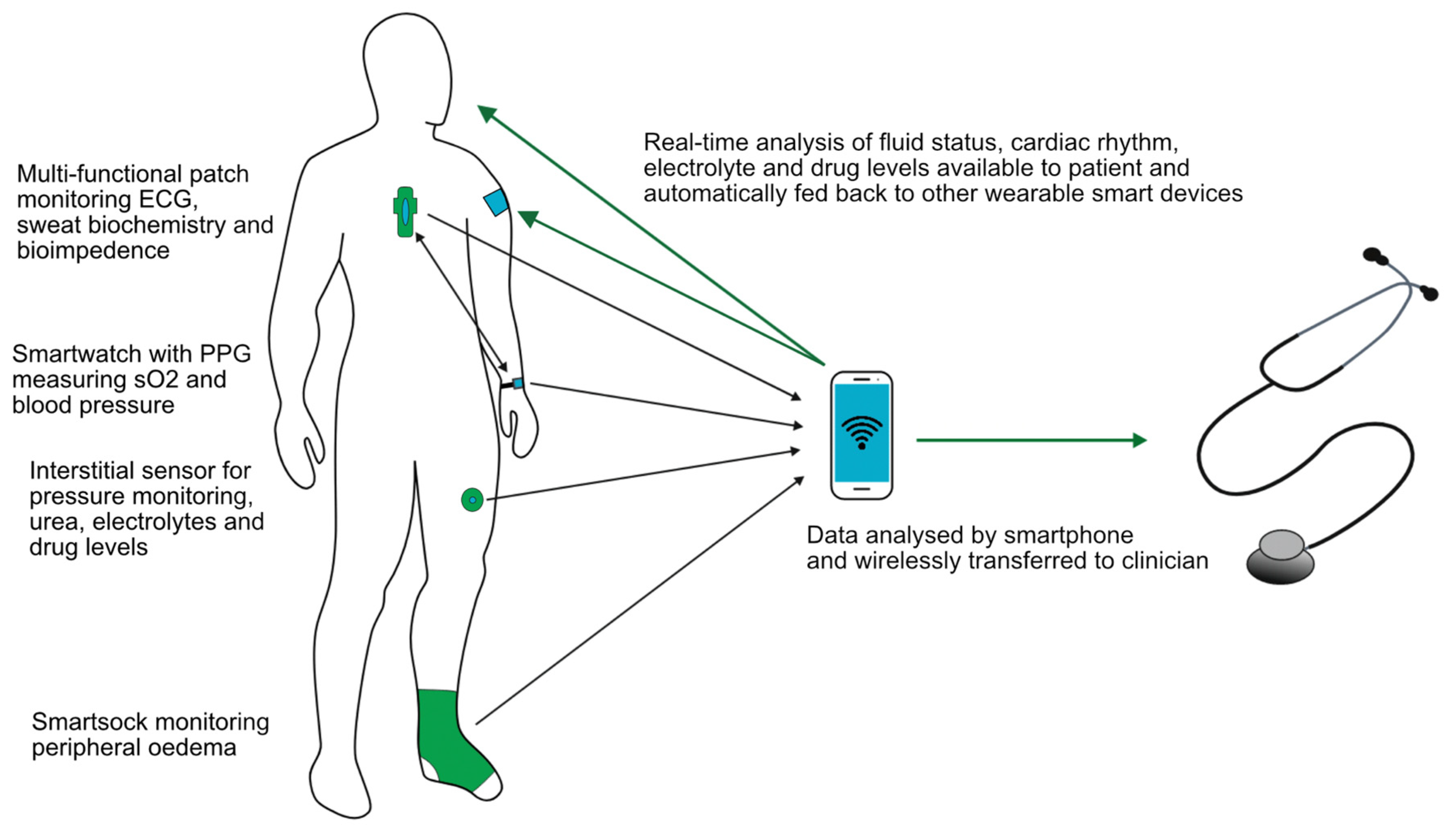 Sensors | Free Full-Text | Wearables in Nephrology: Fanciful Gadgetry or  Pr&ecirc;t-&agrave;-Porter?