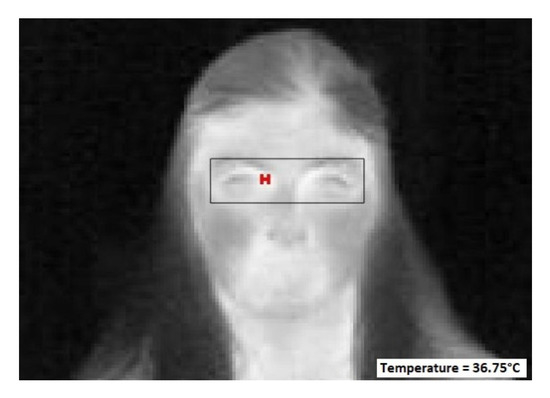 https://www.mdpi.com/sensors/sensors-23-01851/article_deploy/html/images/sensors-23-01851-g017-550.jpg