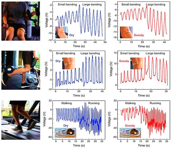 Sensors | Free Full-Text | Wearable Sensors and Smart Devices to