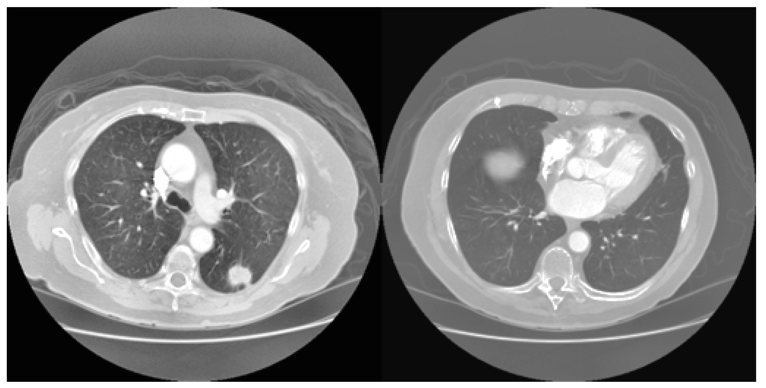 Sensors 23 02147 g008