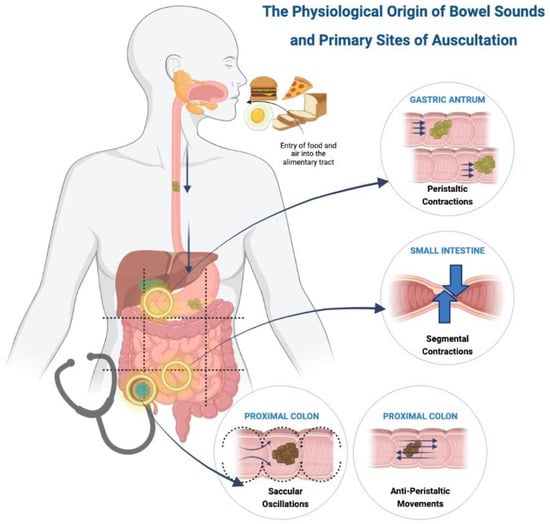 Sensors | Free Full-Text | Practicing Digital Gastroenterology through ...
