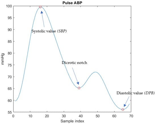 https://www.mdpi.com/sensors/sensors-23-02321/article_deploy/html/images/sensors-23-02321-g006-550.jpg