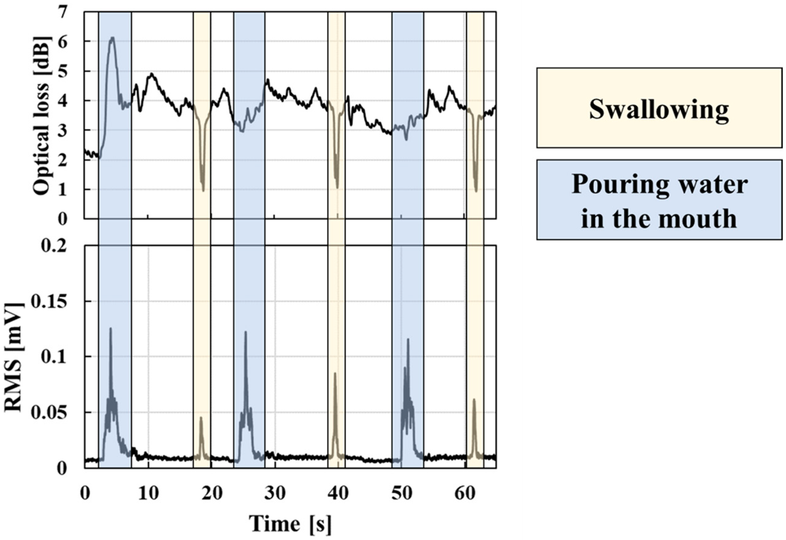 Sensors Free Full Text A Fiber Optic Non Invasive Swallowing Assessment Device Based On A 0879