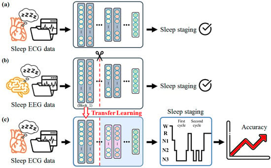 Epilepsy Prediction Using Spark