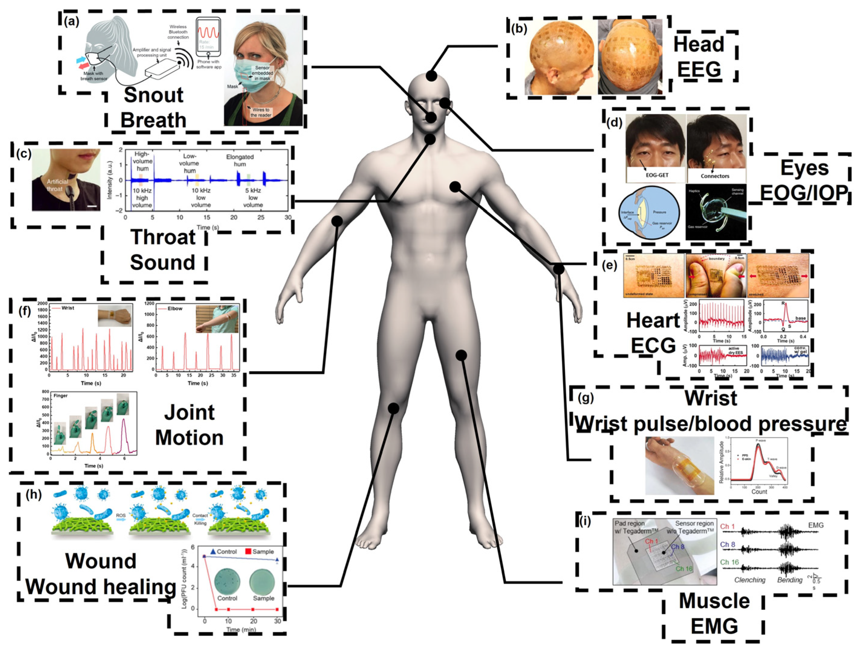 Sensors | Free Full-Text | Smart Wearable Systems for Health Monitoring