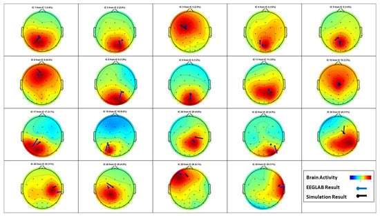 PDF) A test of brain electrical source analysis (BESA): A simulation study