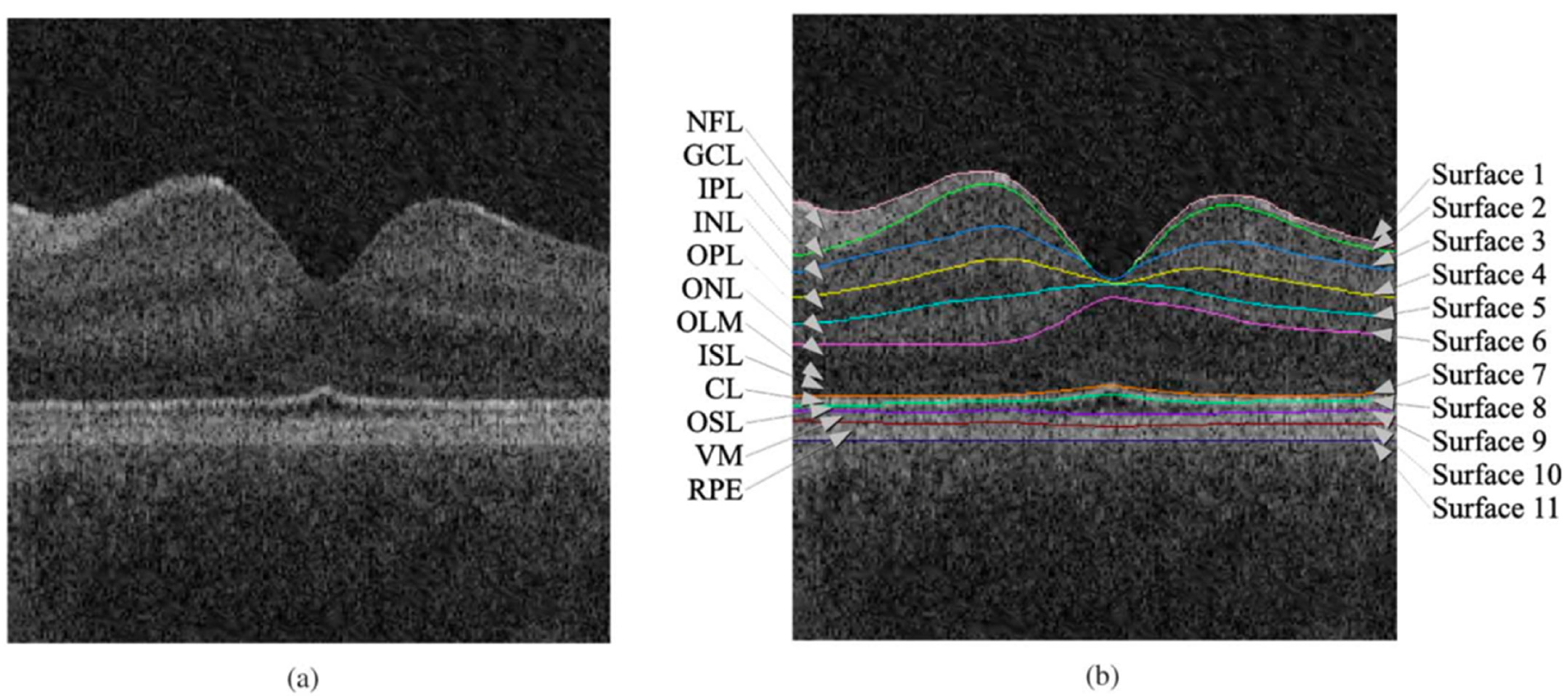 Sensors 23 03144 g003 Sensors 23 03144 g003