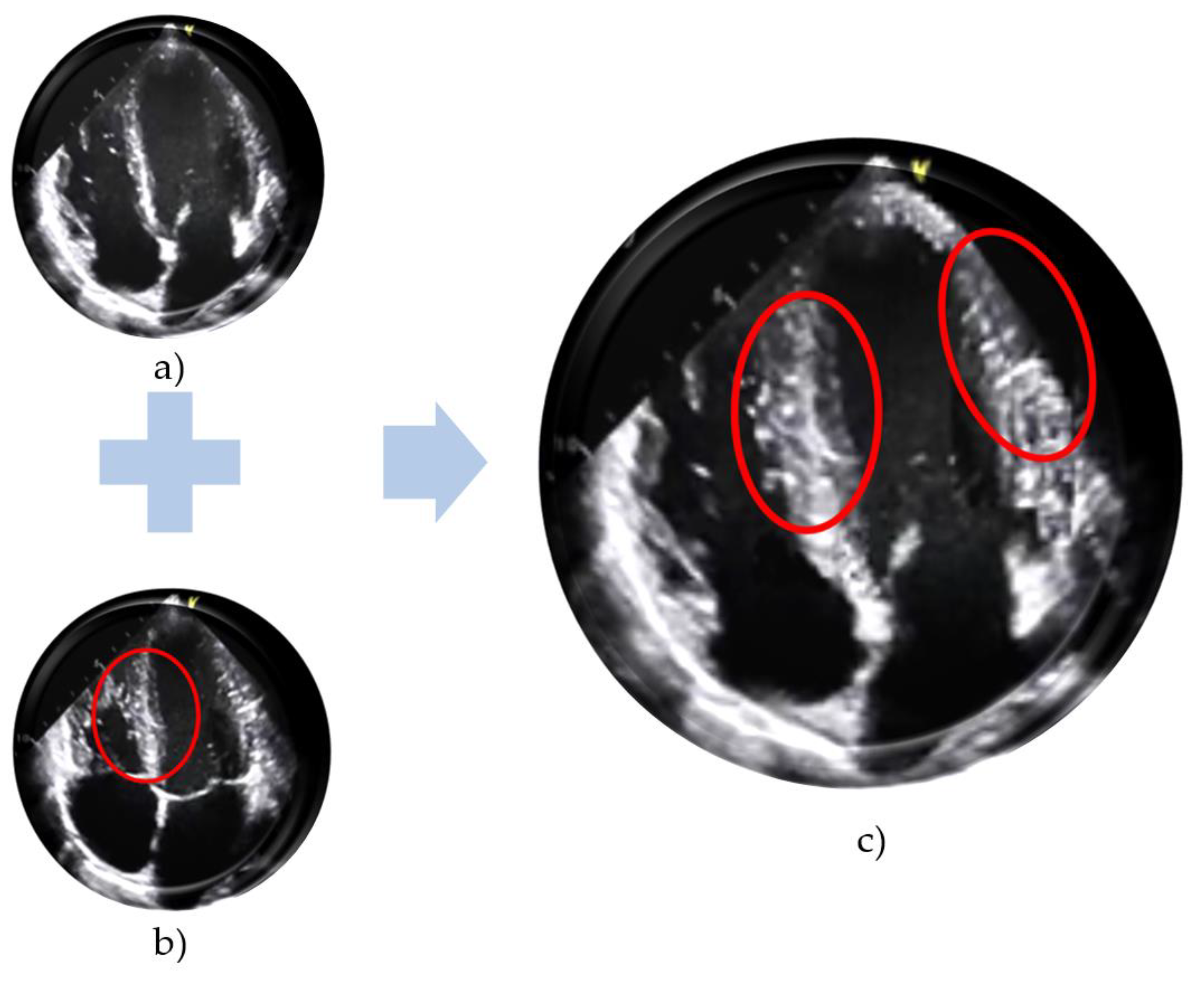 EchoNet-Dynamic Cardiac Ultrasound