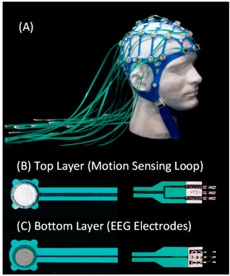 Sensors | Free Full-Text | The MotoNet: A 3 Tesla MRI-Conditional EEG Net  with Embedded Motion Sensors