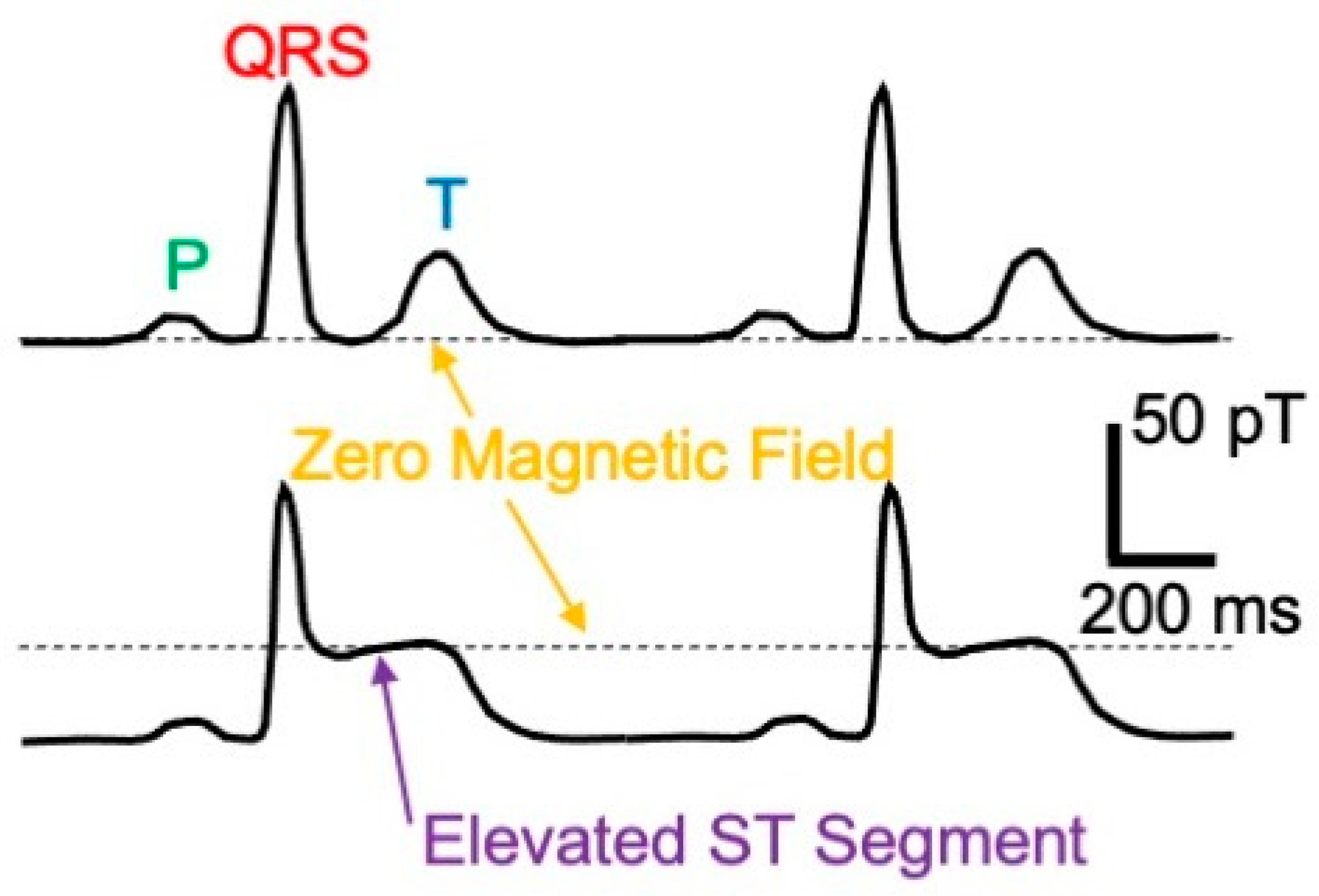 Sensors 23 04218 g003
