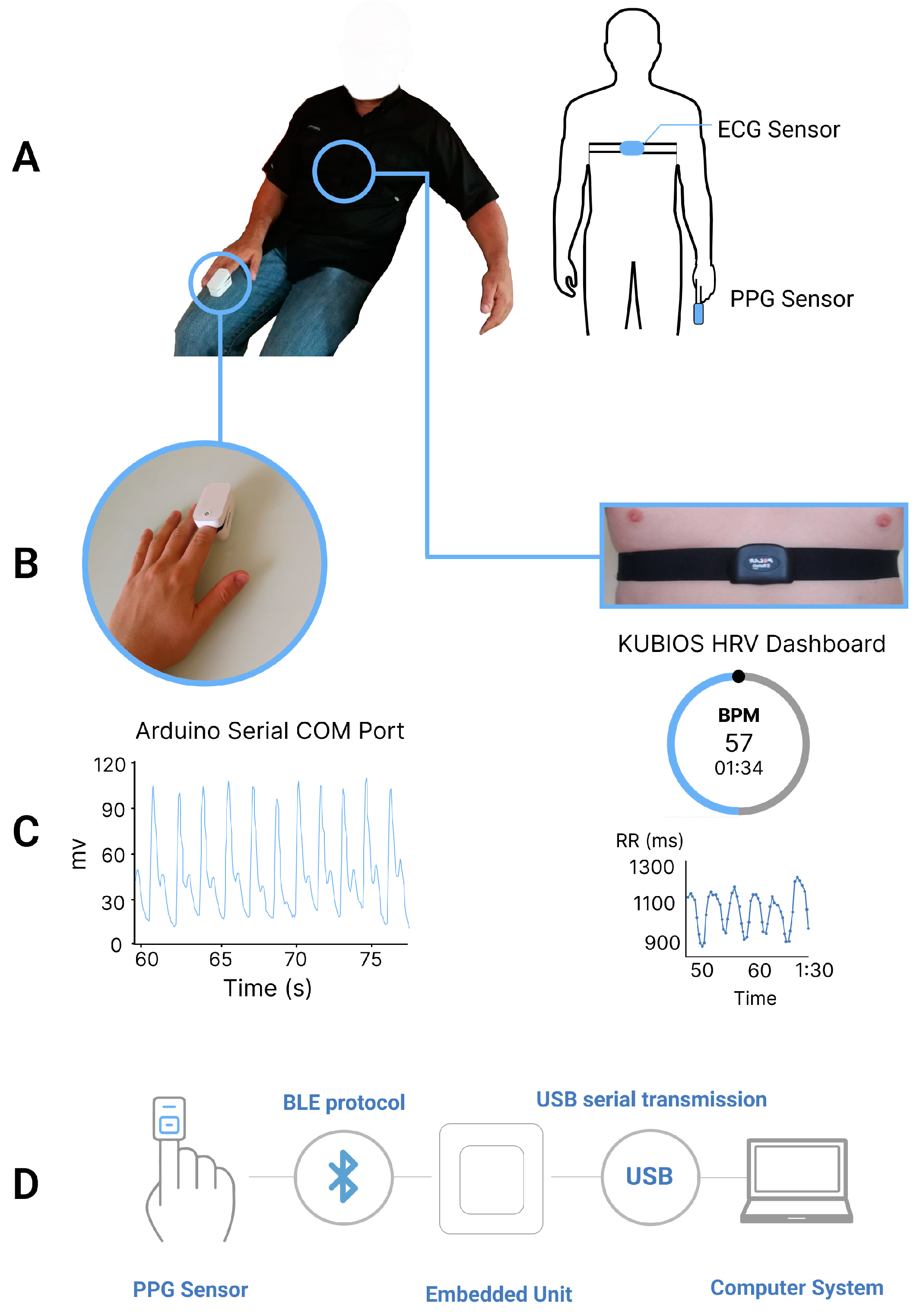 Sensors | Free Full-Text | Real-Time Evaluation of Time-Domain Pulse Rate  Variability Parameters in Different Postures and Breathing Patterns Using  Wireless Photoplethysmography Sensor: Towards Remote Healthcare in  Low-Resource Communities