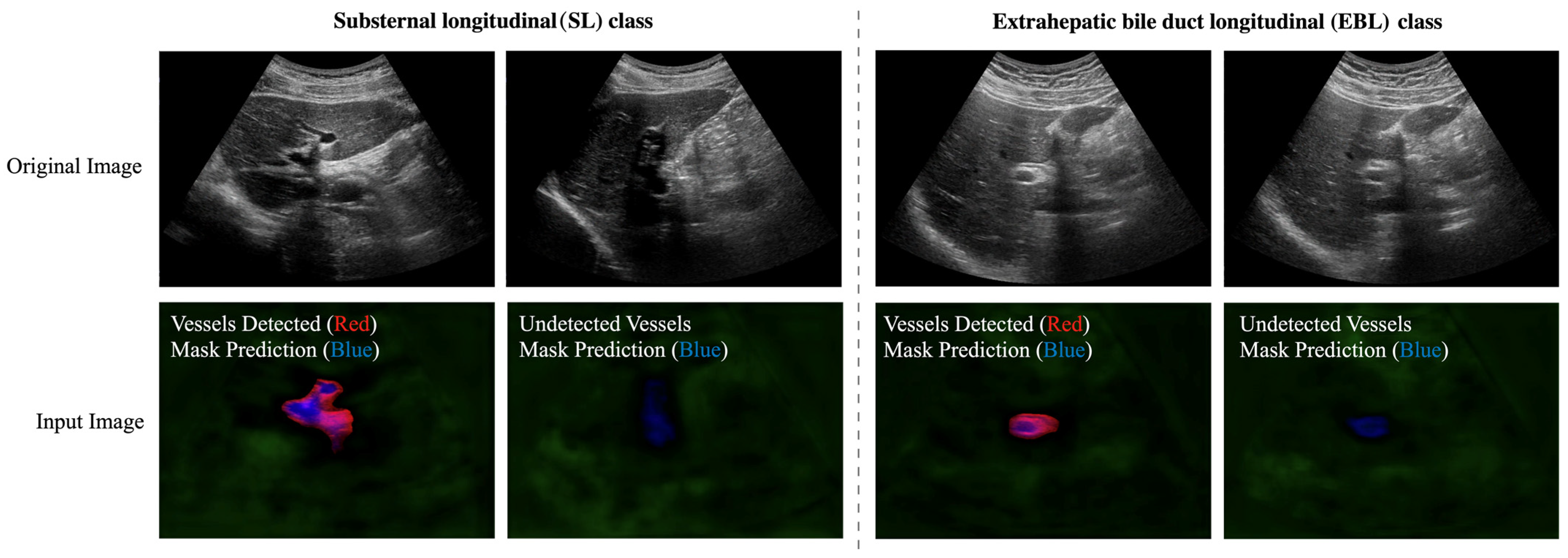 Real-time Burn Classification using Ultrasound Imaging