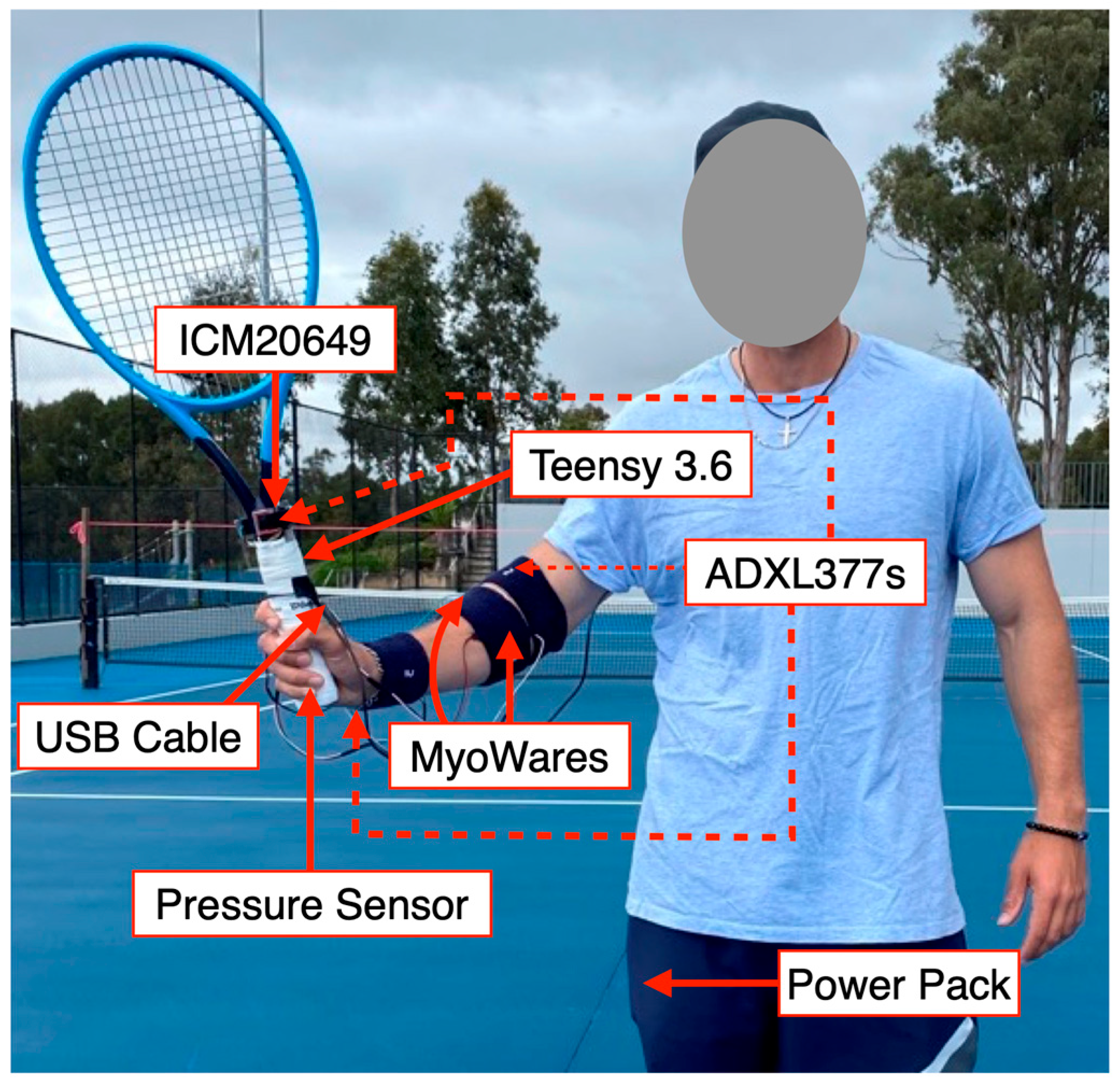 Sensors | Free Full-Text | Comparison of Grip Strength, Forearm Muscle  Activity, and Shock Transmission between the Forehand Stroke Technique of  Experienced and Recreational Tennis Players Using a Novel Wearable Device