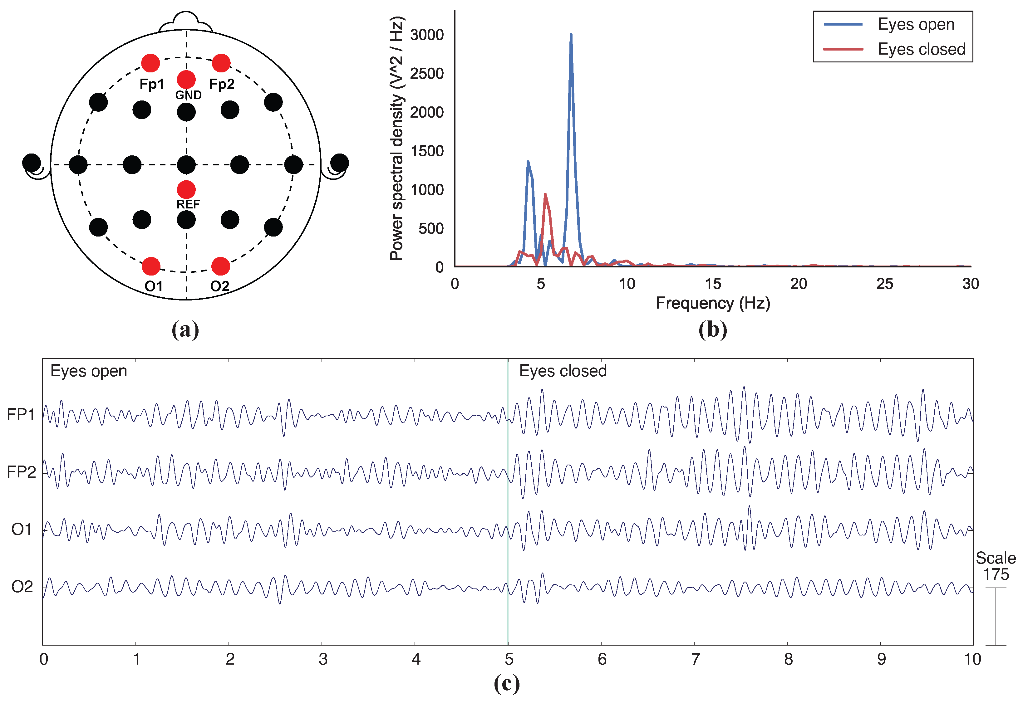Sensors 23 05175 g007
