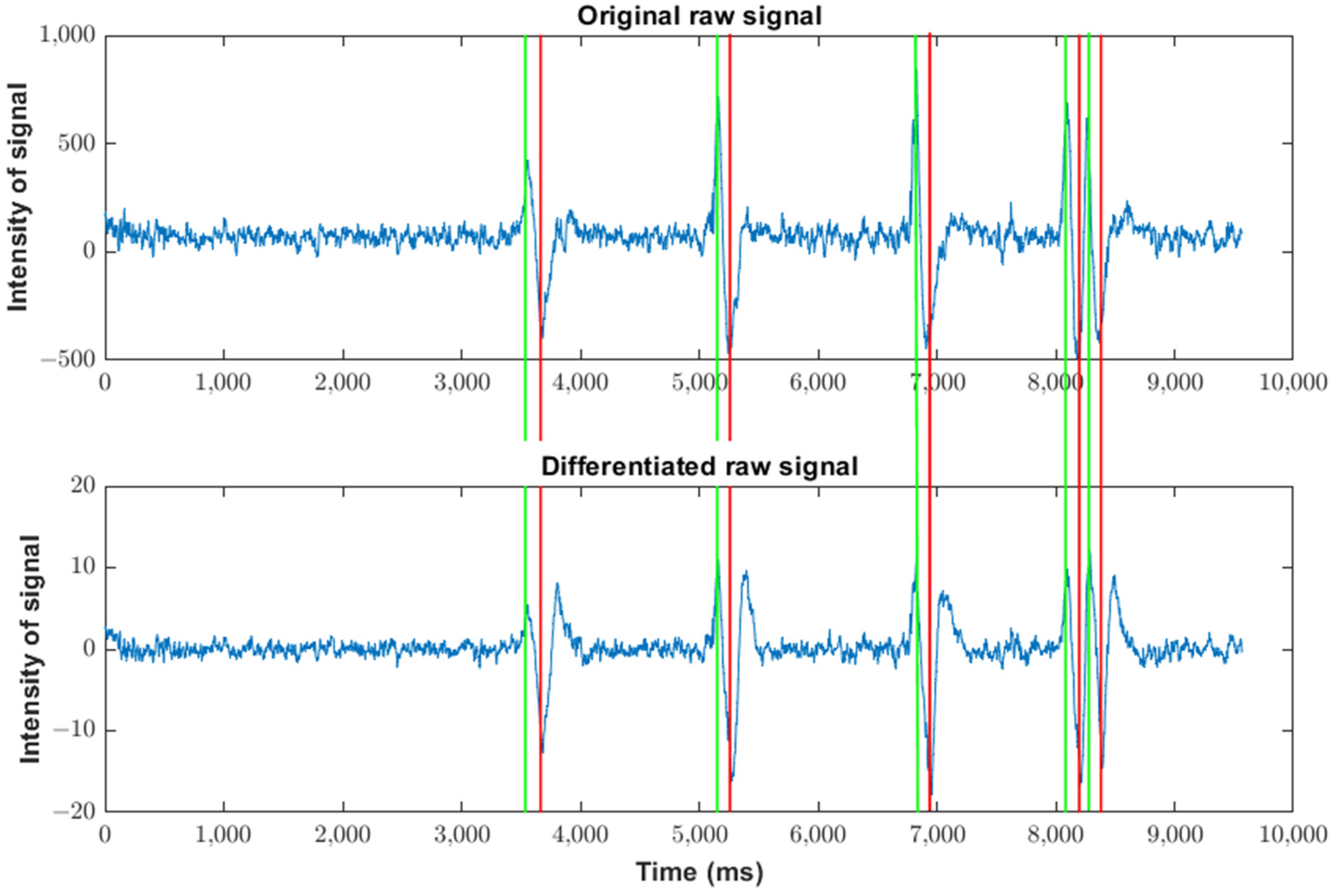 Sensors | Free Full-Text | A Hardware-Based Configurable Algorithm for ...