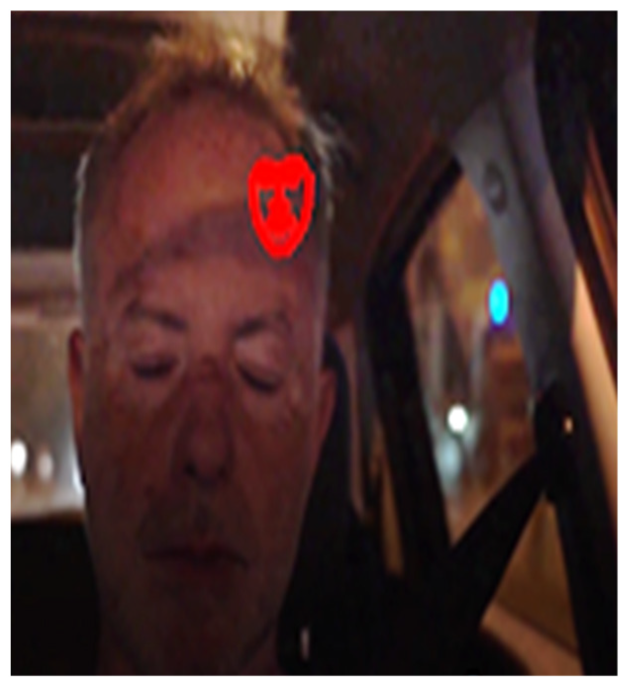 Sensors 23 06344 g004 Sensors 23 06344 g004