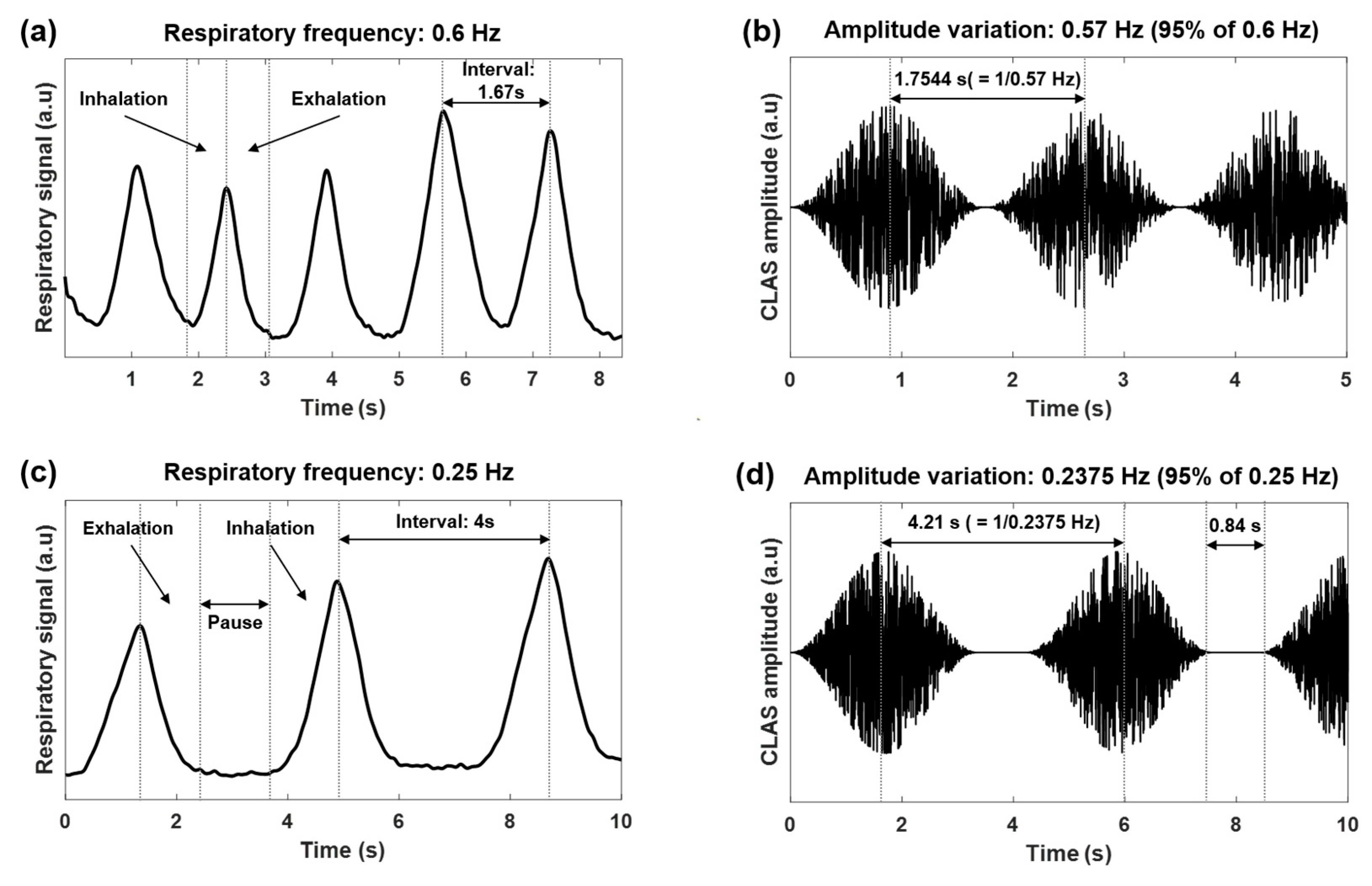 Sensors Free Full Text Closed Loop Auditory Stimulation to