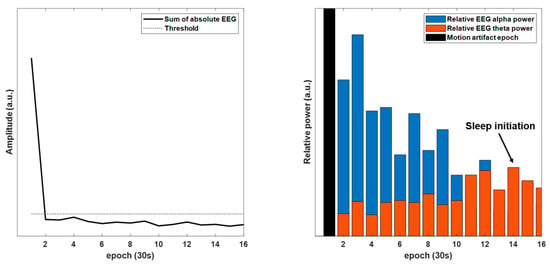 Sensors Free Full Text Closed Loop Auditory Stimulation to