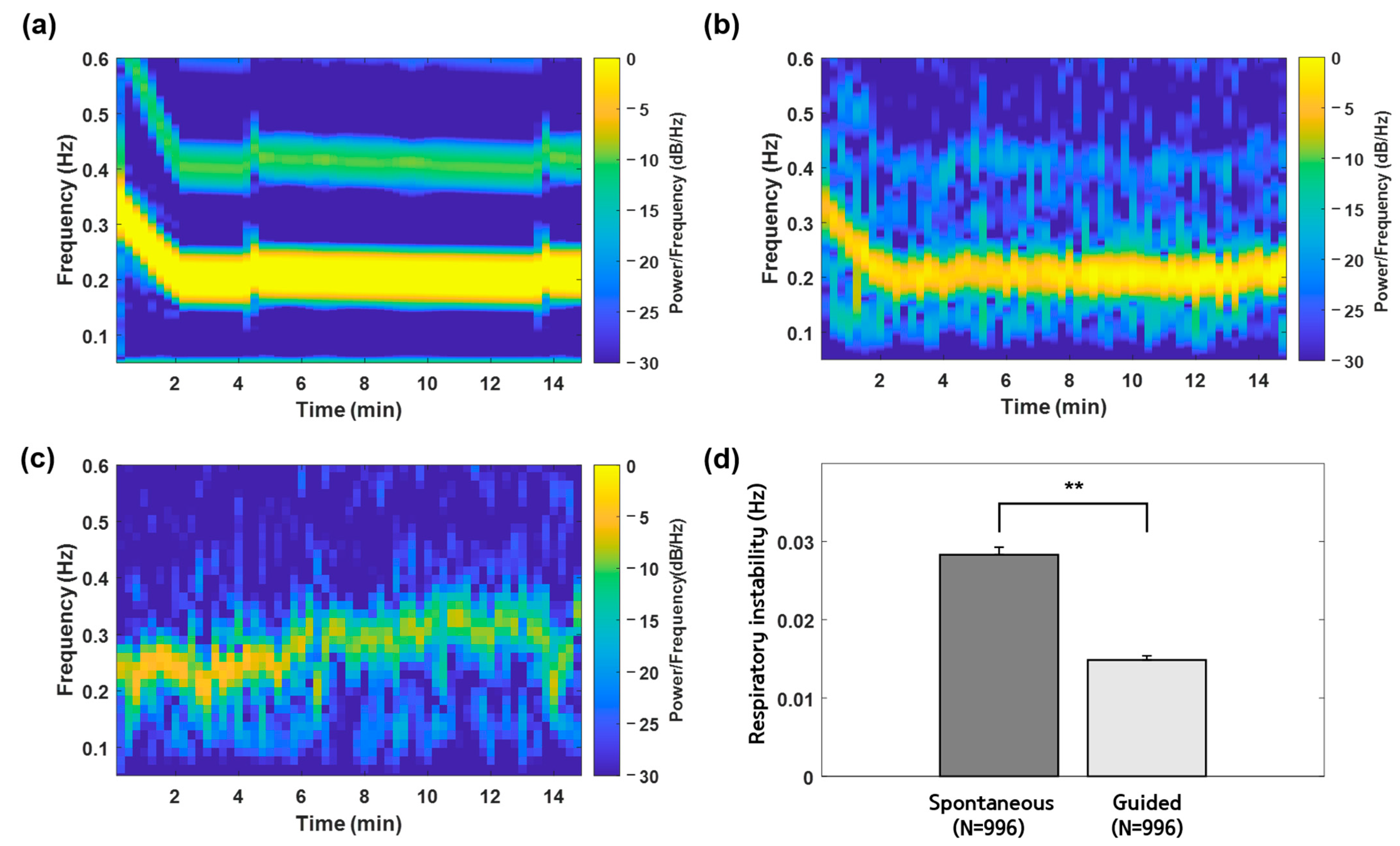 Sensors Free Full Text Closed Loop Auditory Stimulation to