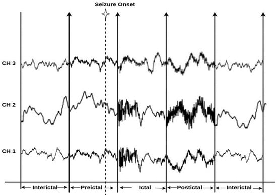 https://www.mdpi.com/sensors/sensors-23-06578/article_deploy/html/images/sensors-23-06578-g001-550.jpg