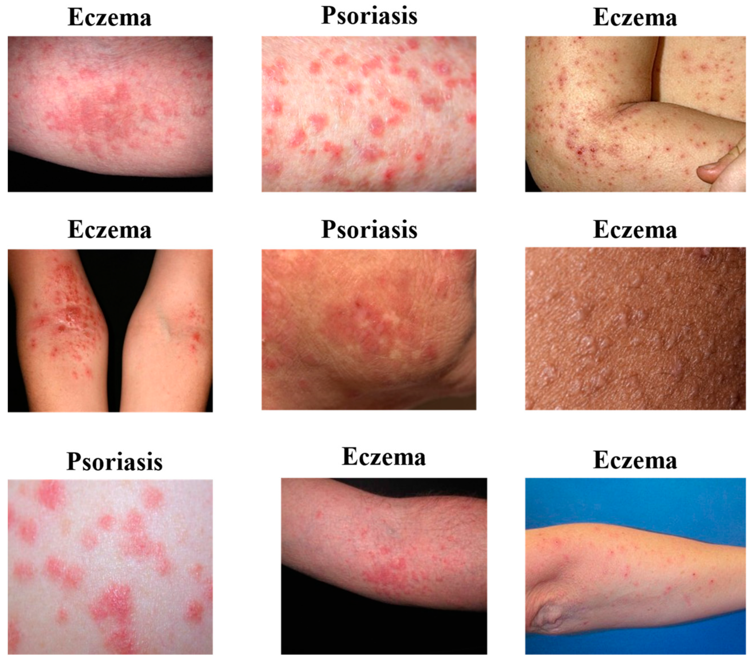 How Telemedicine Can Diagnose 16 Common Skin Rashes - Care on Location