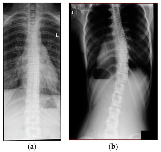 Sensors | Free Full-Text | Non-Invasive Assessment of Back Surface ...