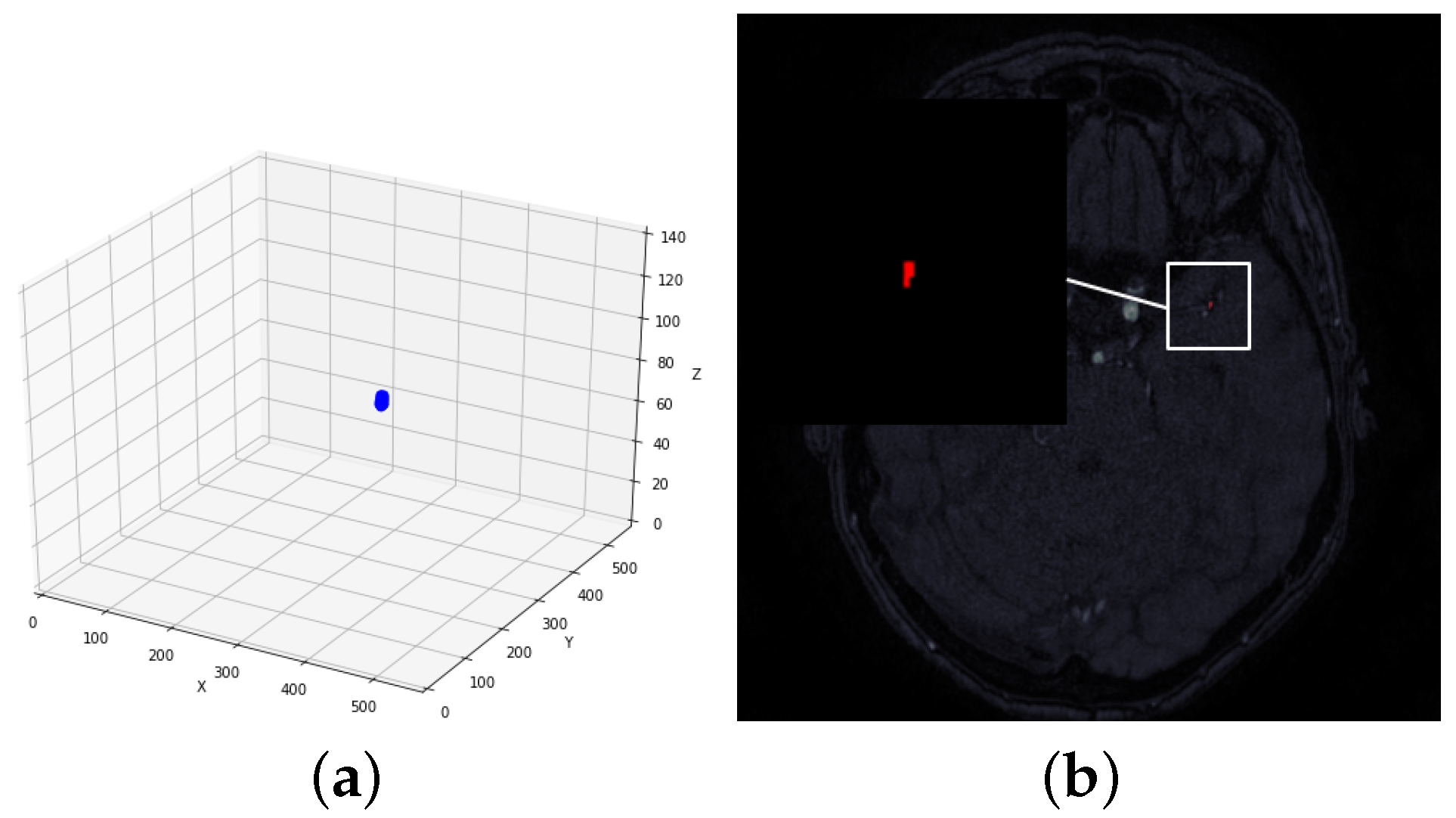 Deep learning integral imaging for three-dimensional visualization, object  detection, and segmentation - ScienceDirect