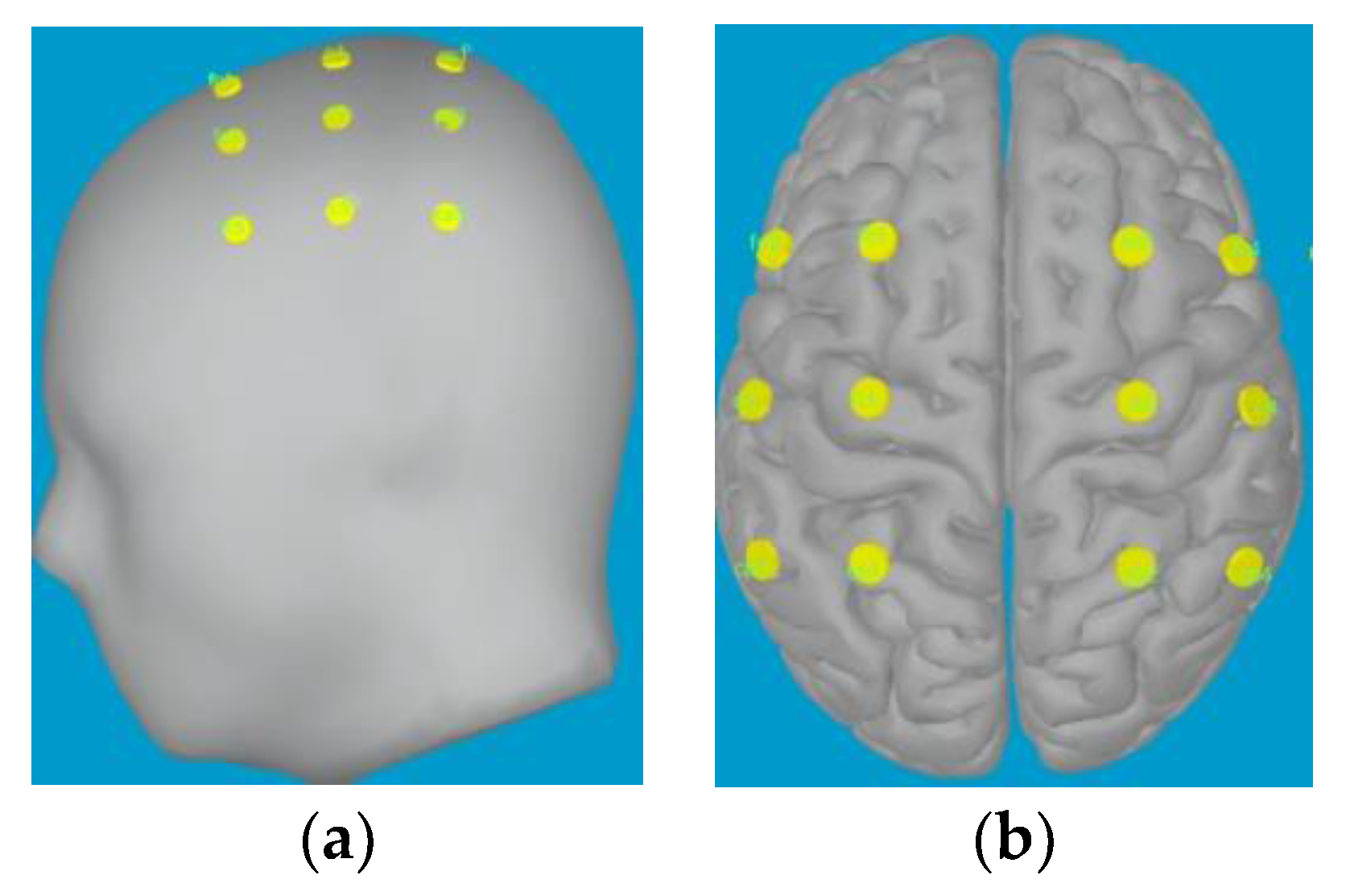 Sensors 23 08893 g005