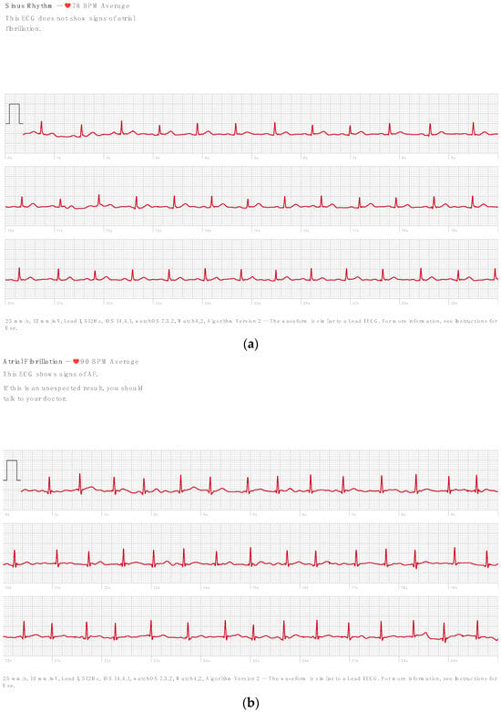 Apple watch ekg outlet switzerland