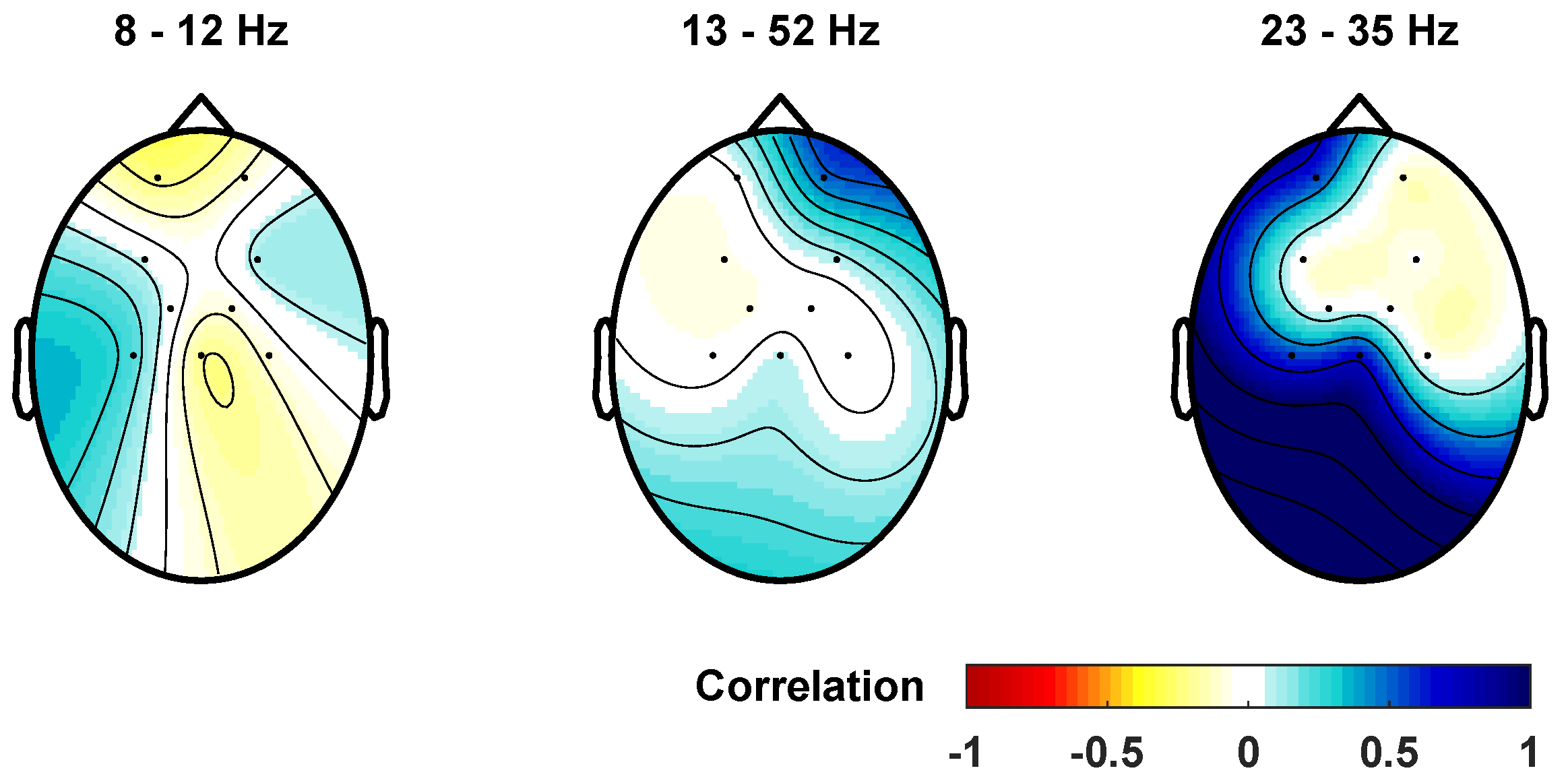 Pathway-specific modulatory effects of neuromuscular electrical stimulation  during pedaling in chronic stroke survivors, Journal of NeuroEngineering  and Rehabilitation