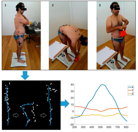 Lifting and Low Back Pain