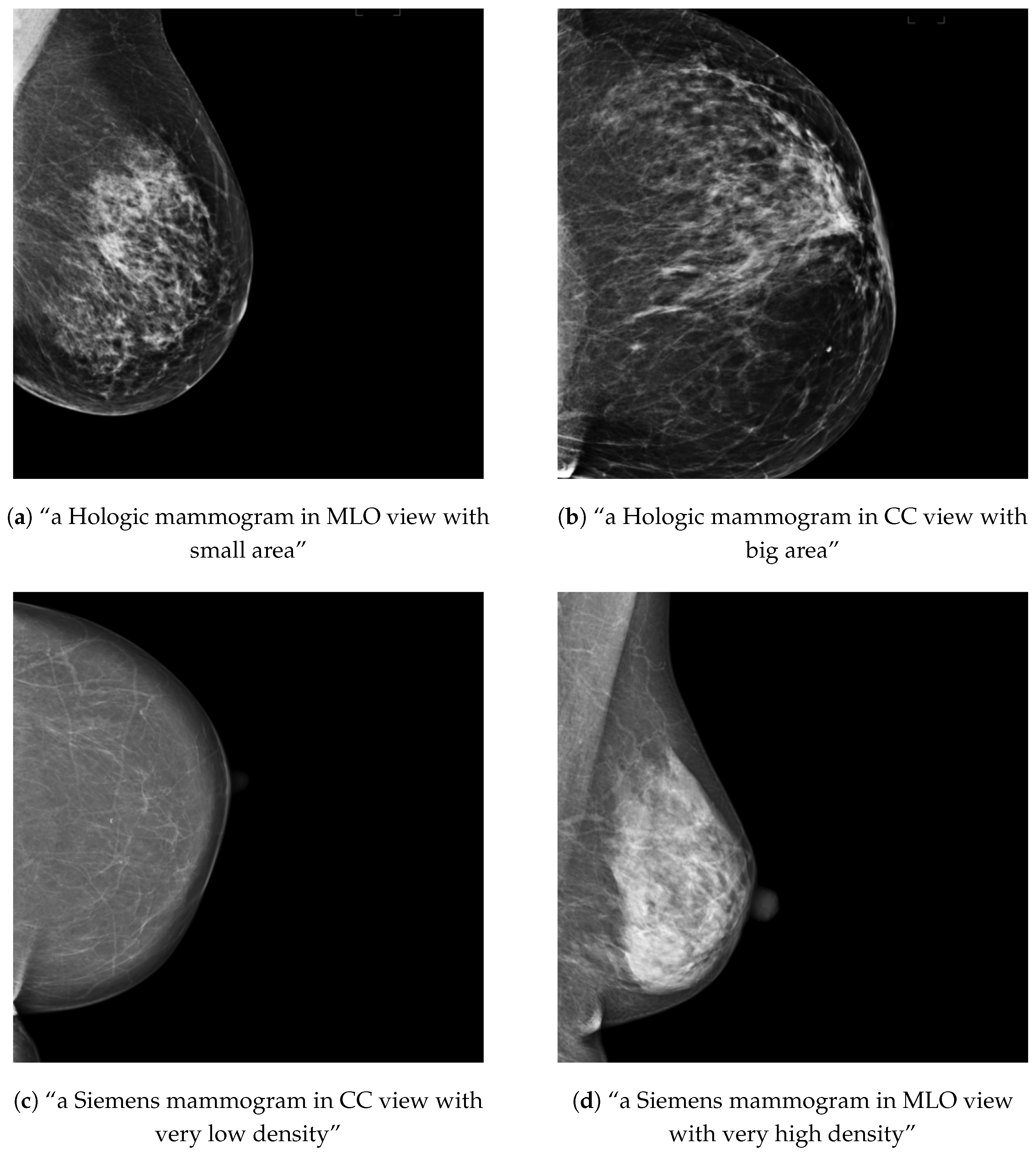 Sensors | Free Full-Text | MAM-E: Mammographic Synthetic Image ...