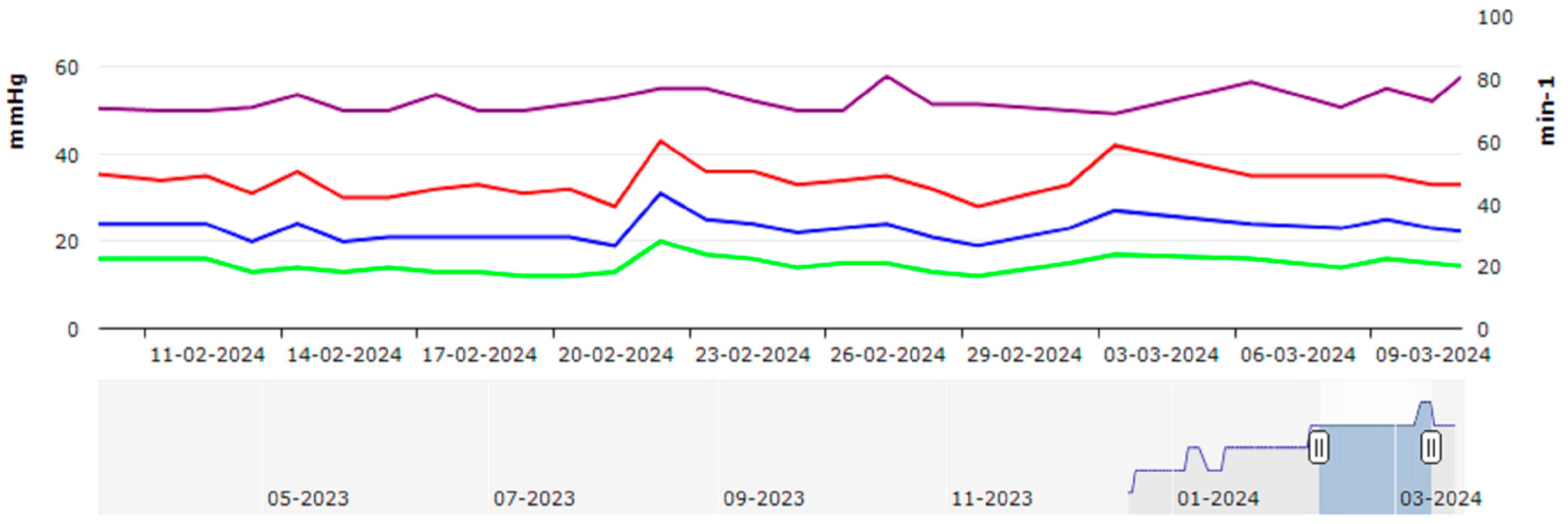 Sensors 24 02922 g001