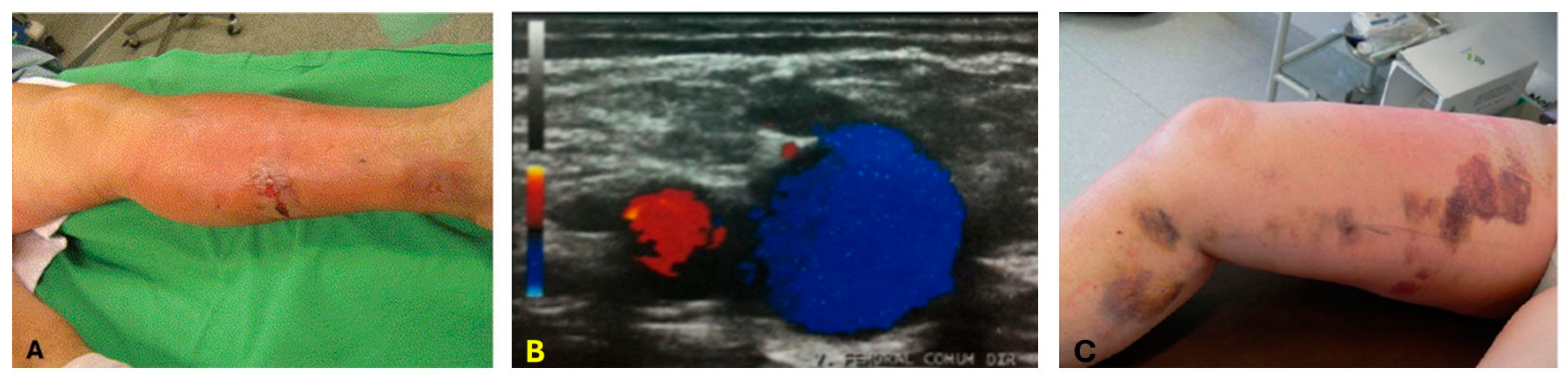 Sensors 24 03542 g002