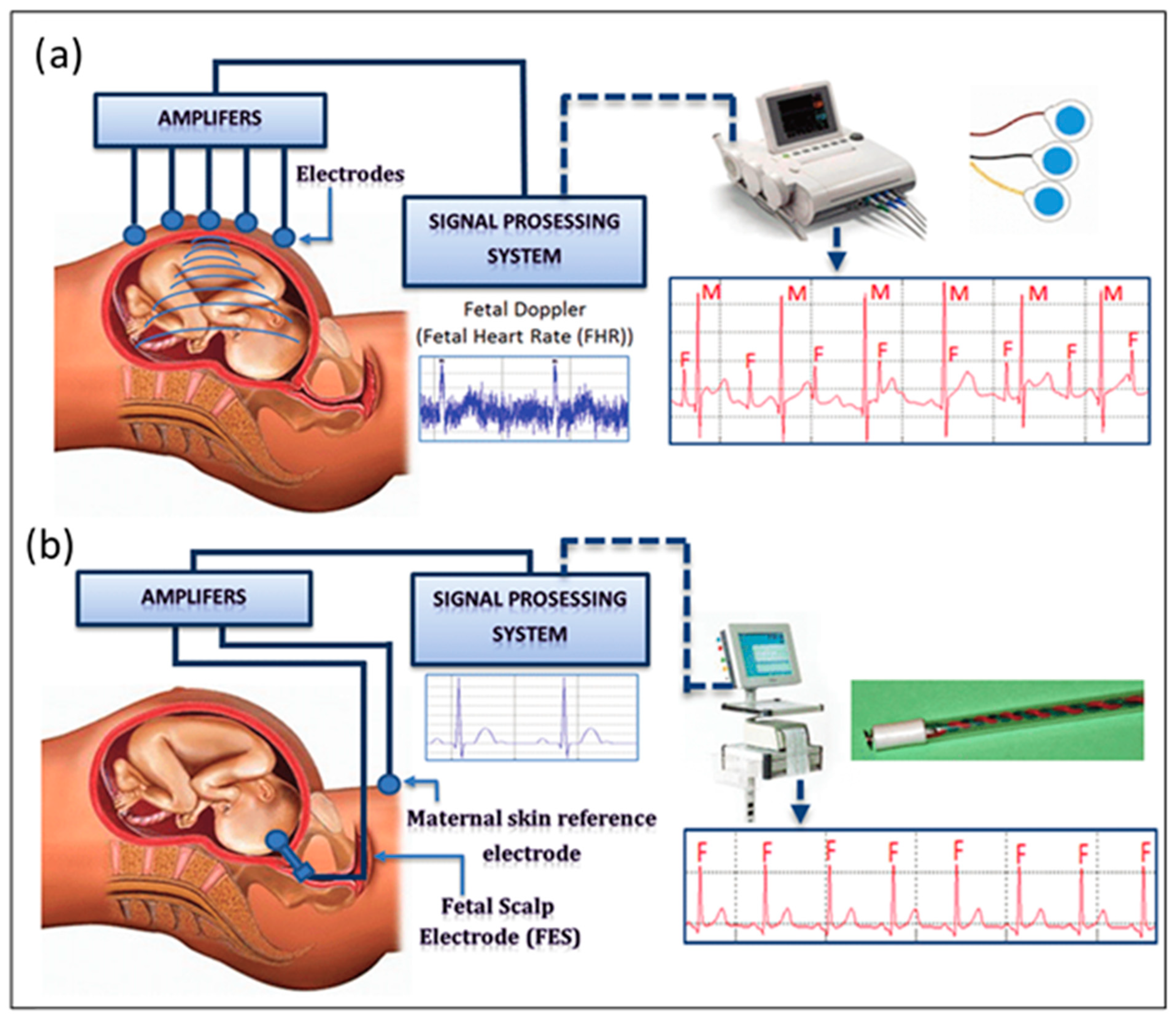 Sensors 24 06066 g001