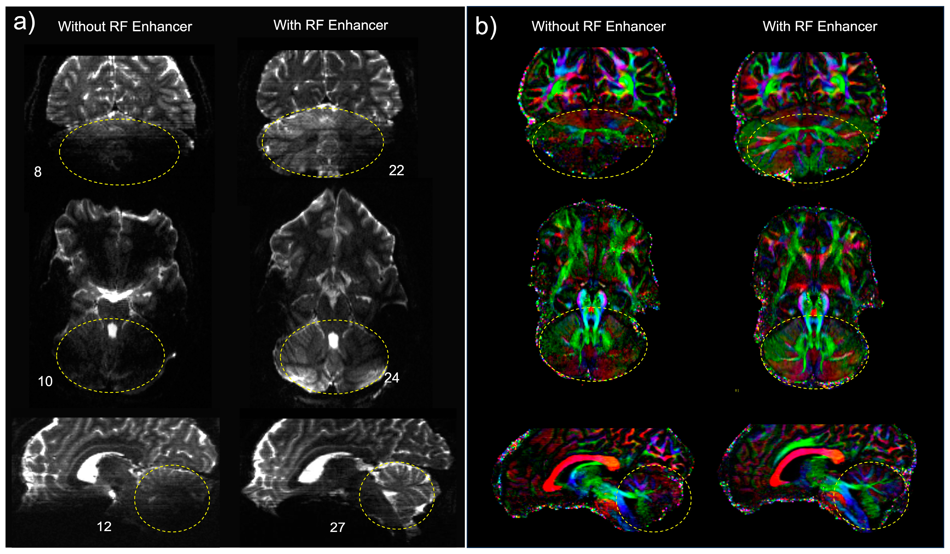 Sensors 24 06981 g008