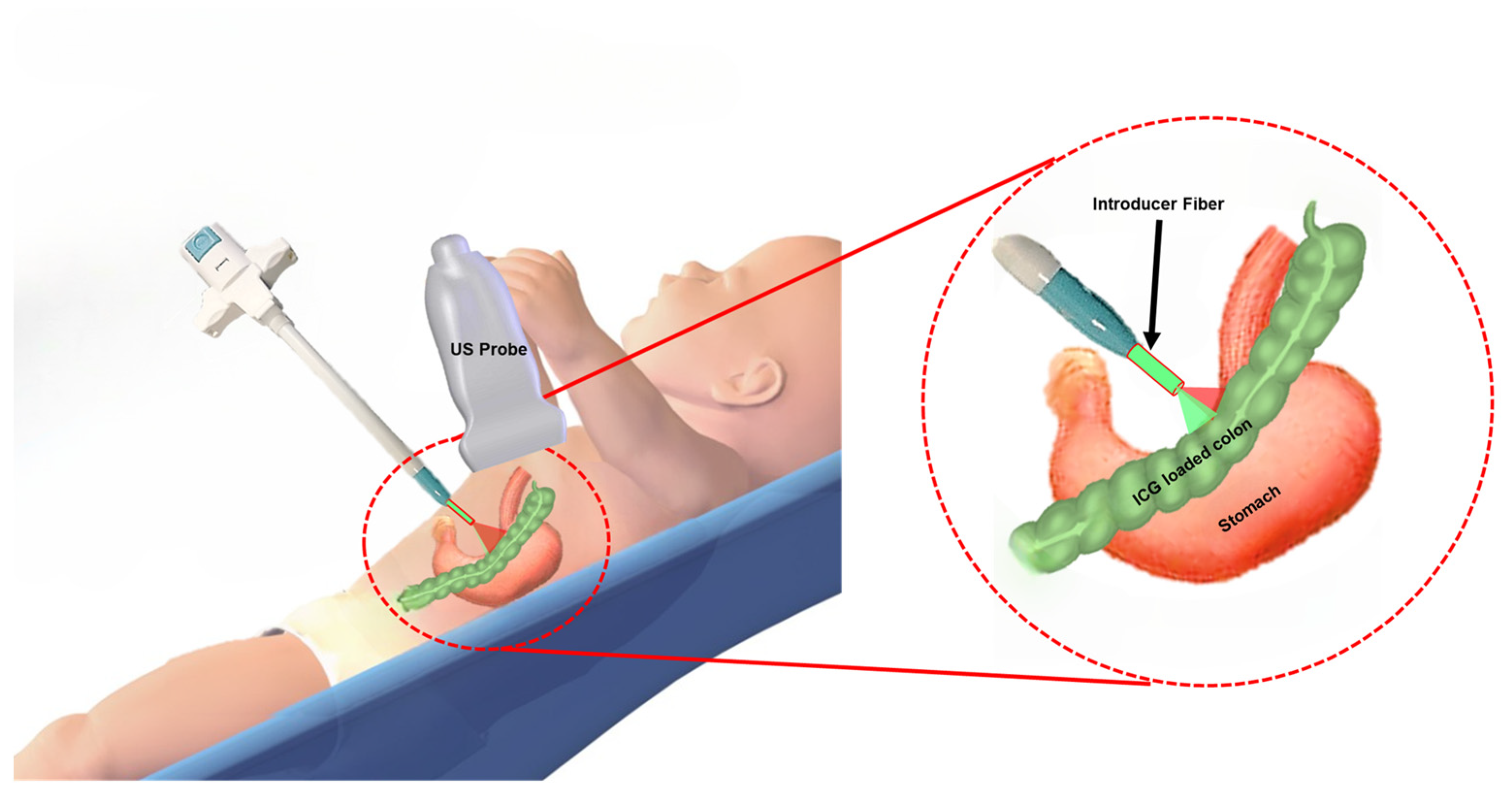 Sensors 25 01597 g001