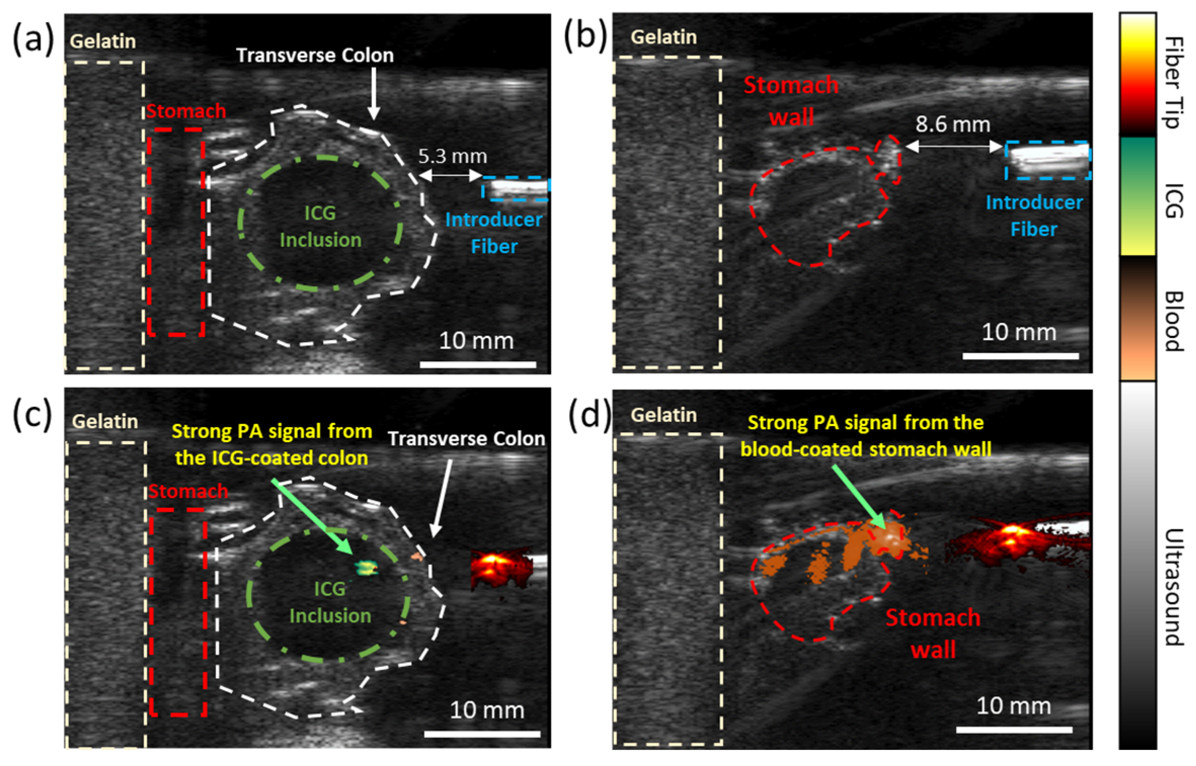 Sensors 25 01597 g004