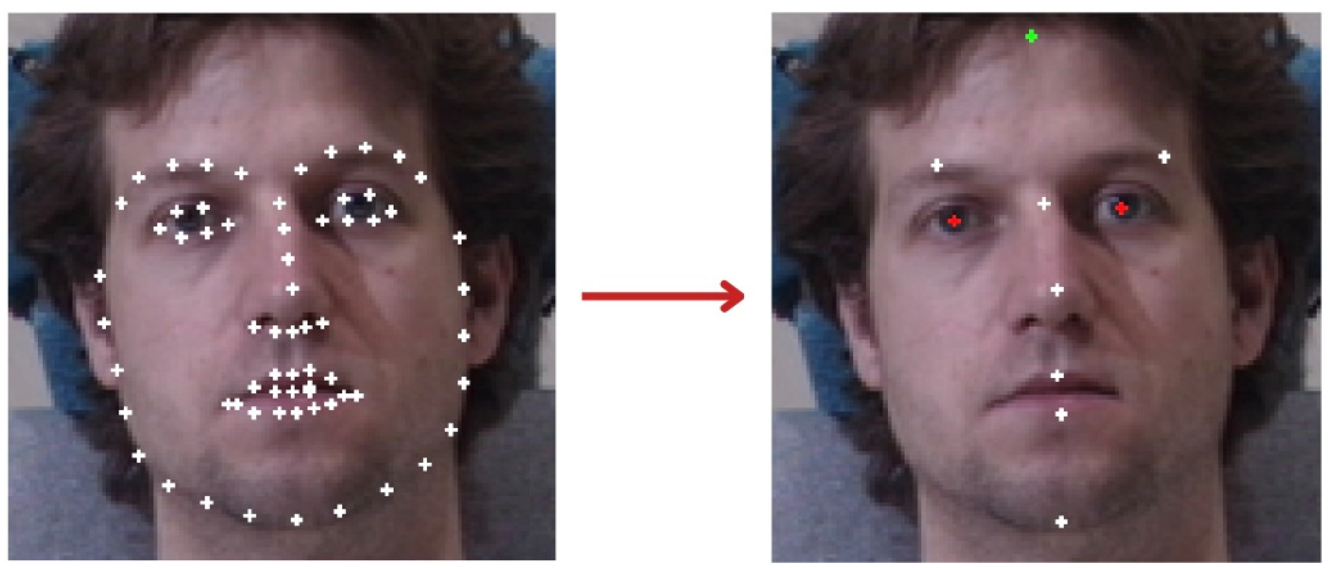 Sensors 25 01638 g004 Sensors 25 01638 g004