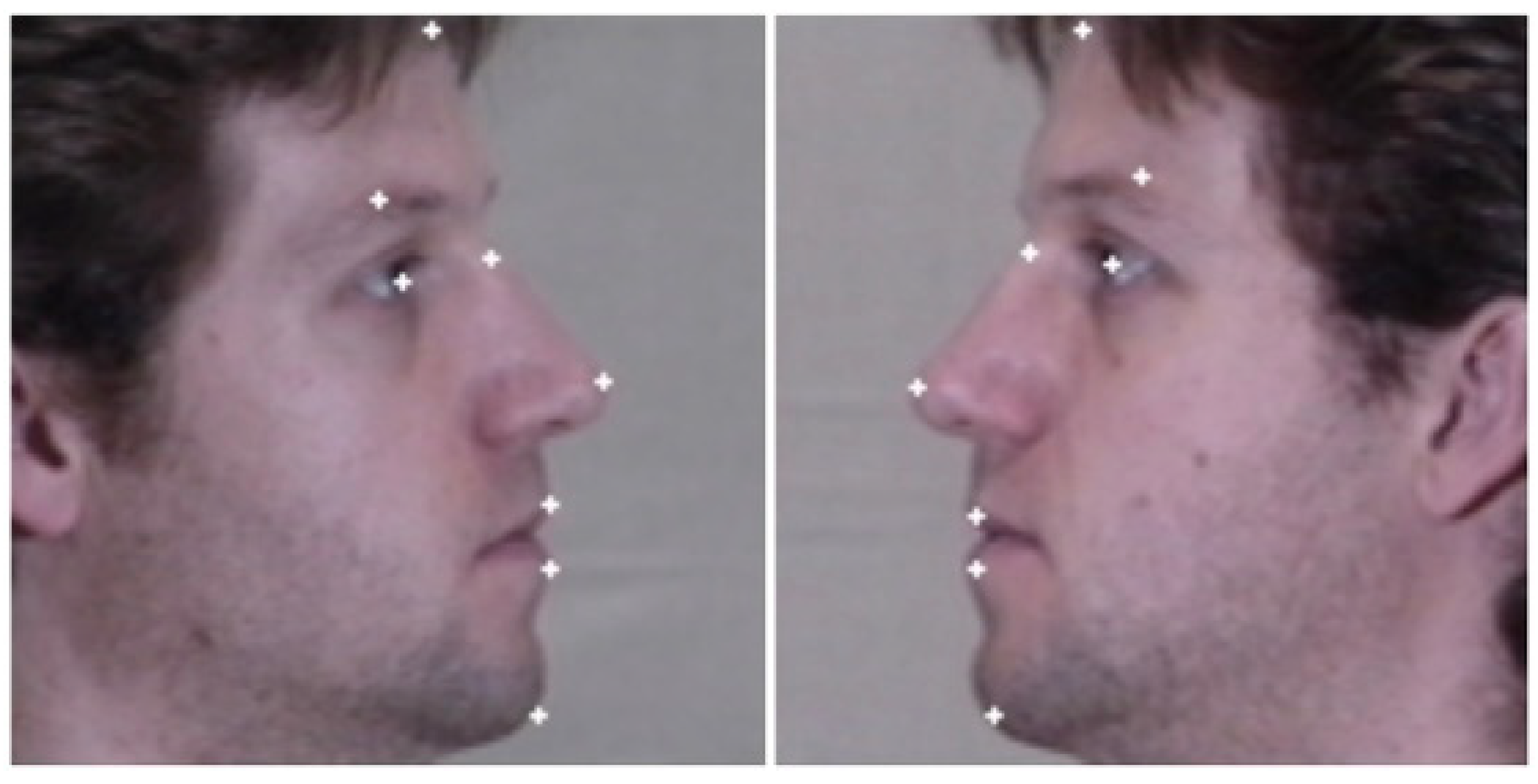 Sensors 25 01638 g005 Sensors 25 01638 g005