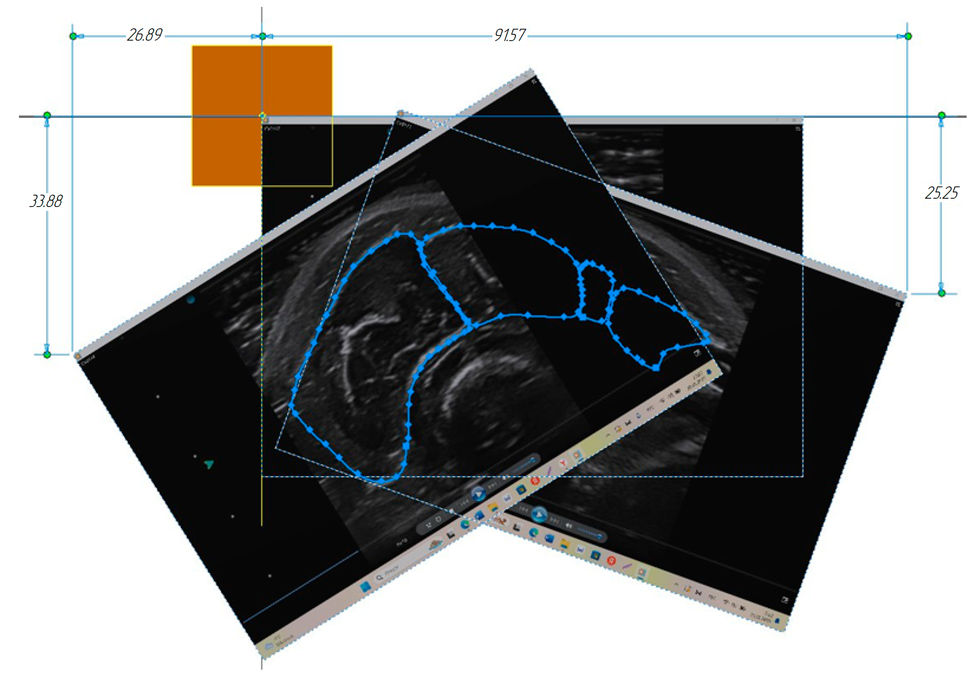 Sensors 25 02298 g012