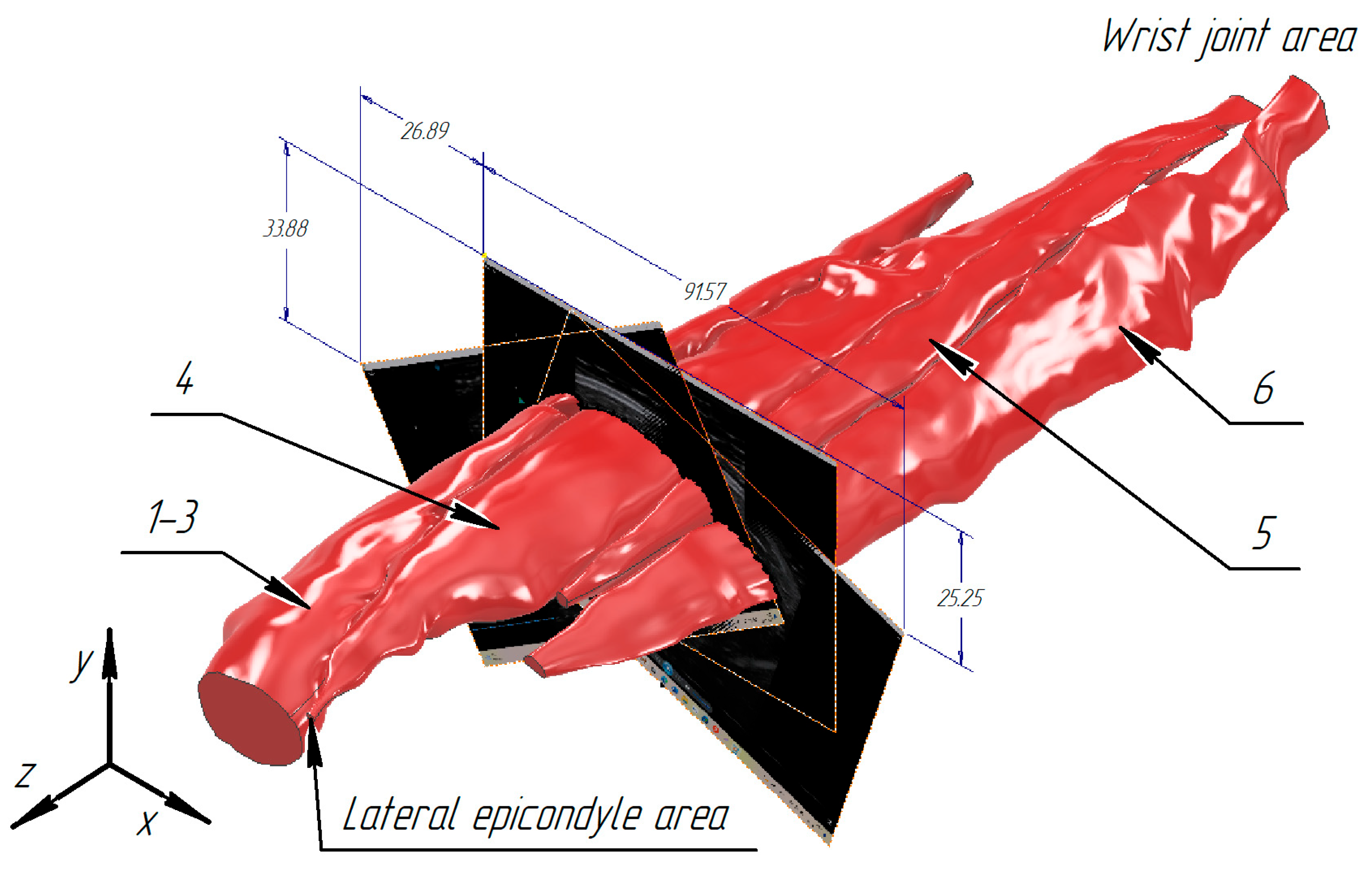 Sensors 25 02298 g013