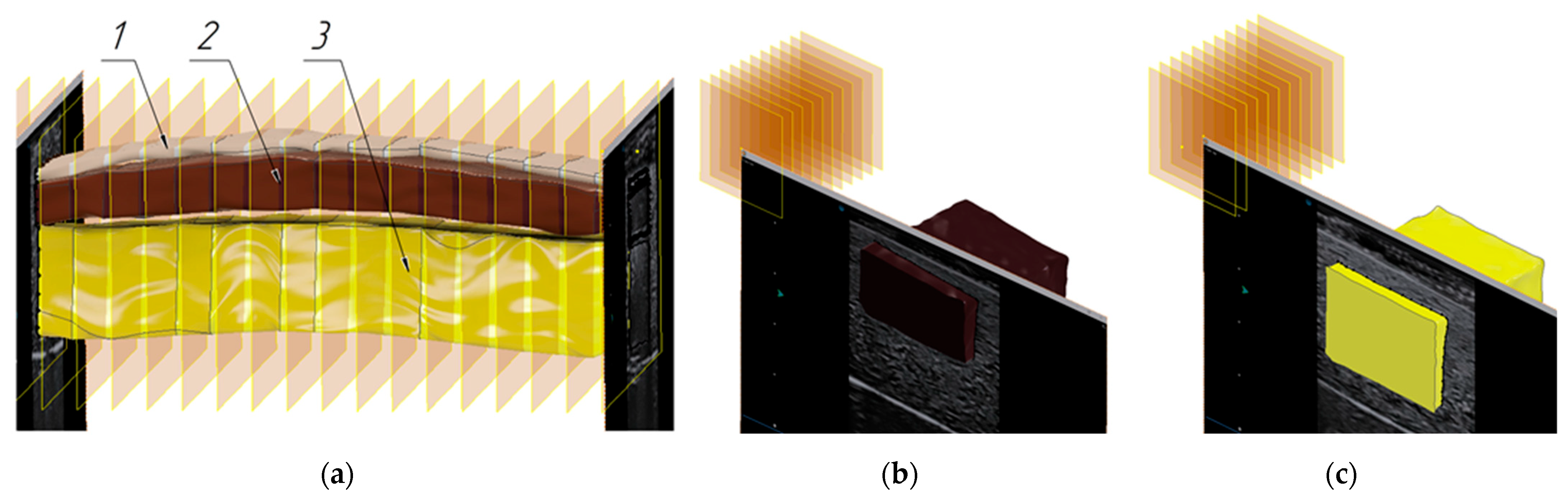 Sensors 25 02298 g018