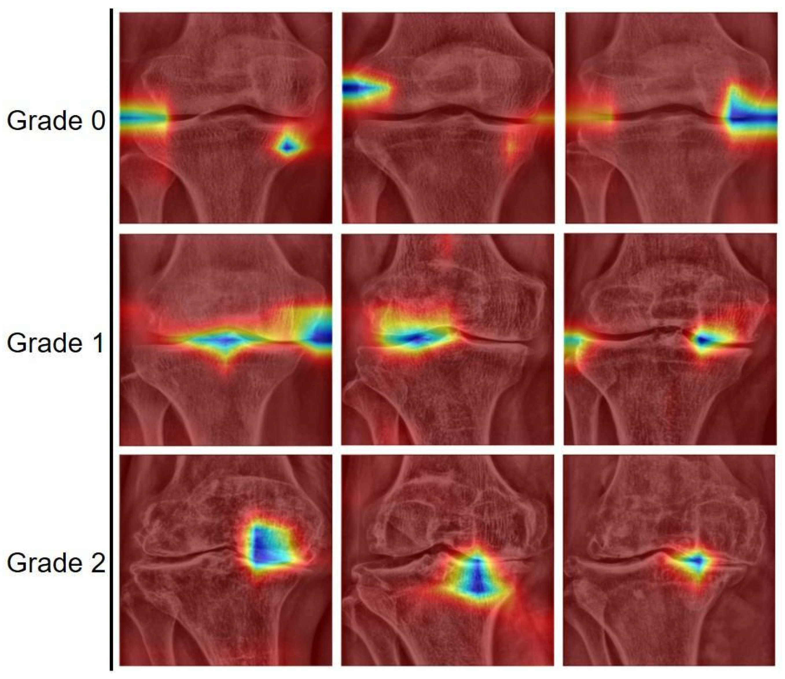 Sensors 25 02535 g005