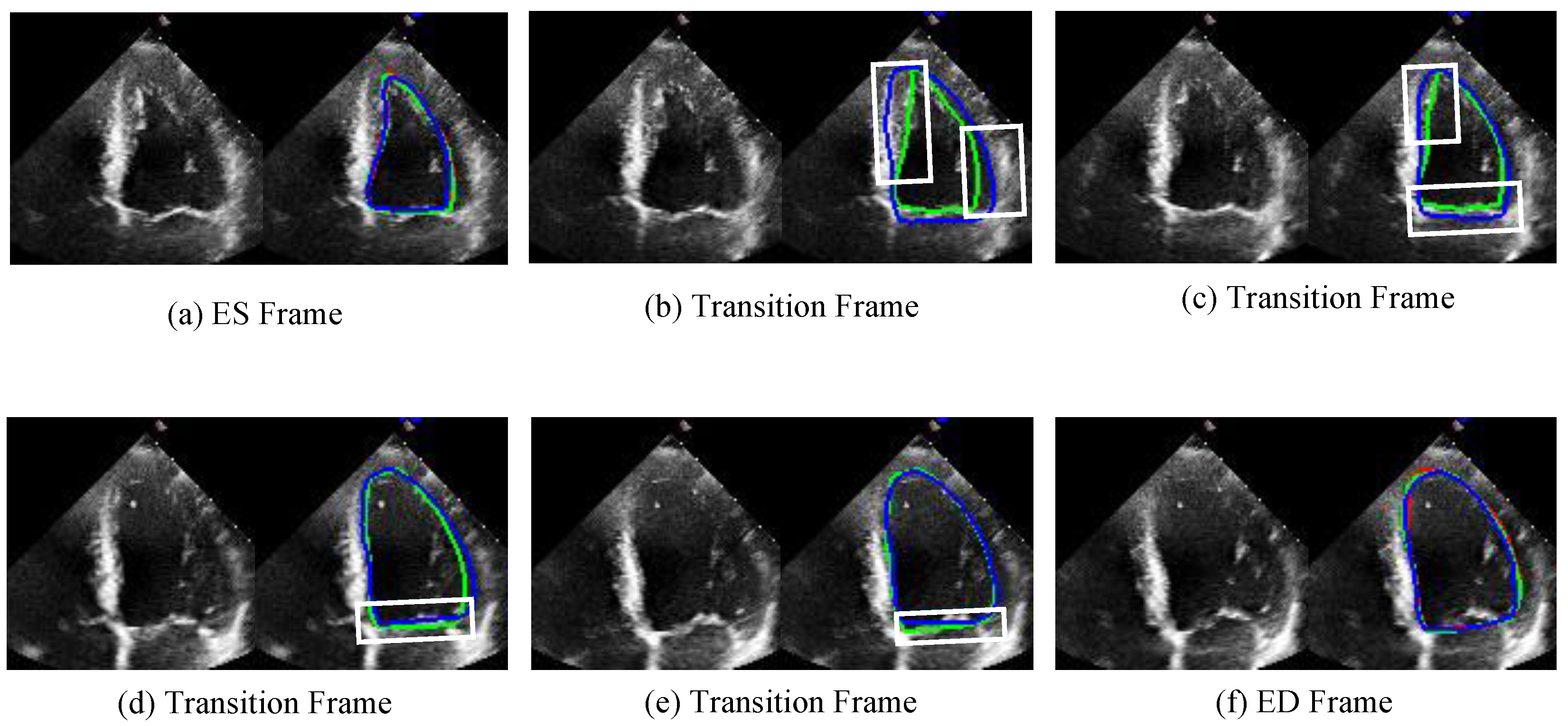 Sensors 25 02704 g007