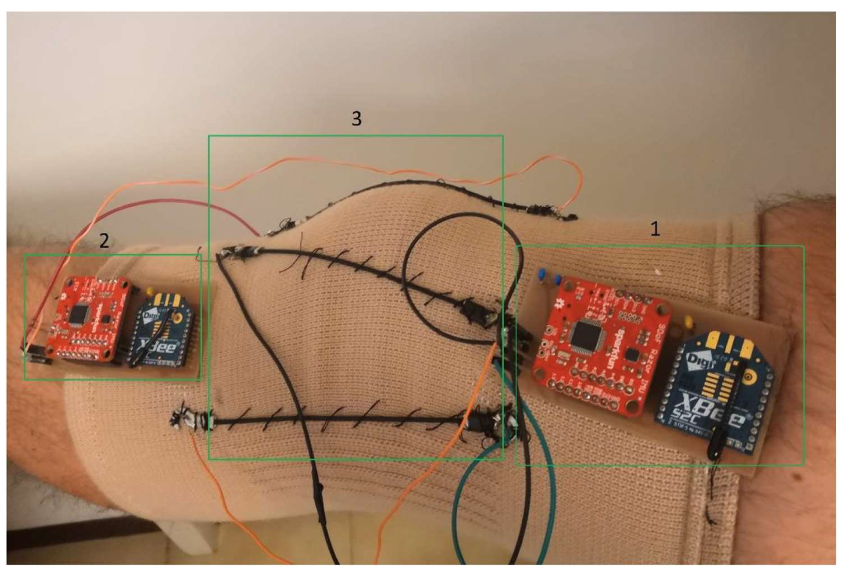 Sensors 25 05837 g002 Sensors 25 05837 g002