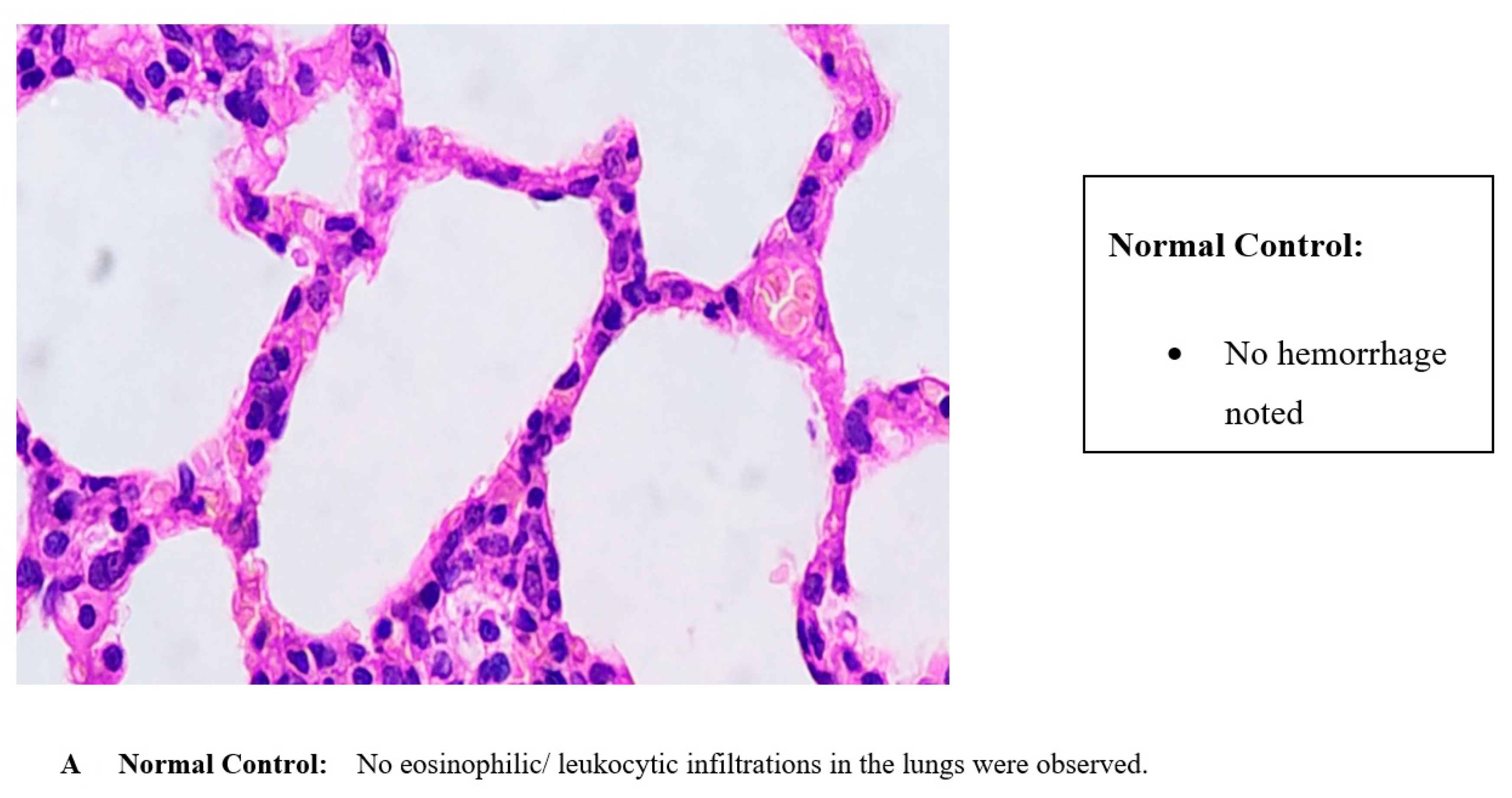 Sinusitis 05 00003 g003a Sinusitis 05 00003 g003a